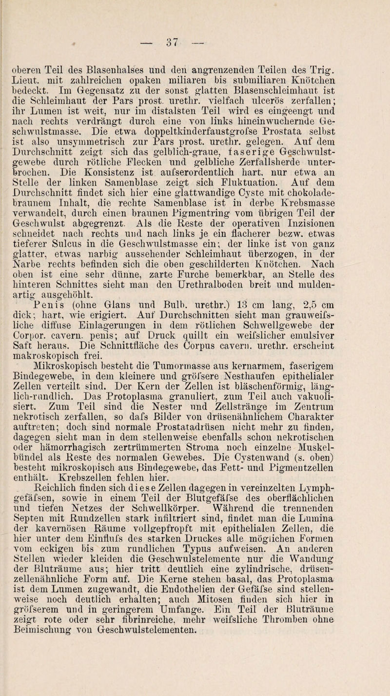 oberen Teil des Blasenhalses und den angrenzenden Teilen des Trig. Lieut. mit zahlreichen opaken miliaren bis submiliaren Knötchen bedeckt. Im Gegensatz zu der sonst glatten Blasenschleimhaut ist die Schleimhaut der Pars prost, uretlir. vielfach ulcerös zerfallen; ihr Lumen ist weit, nur im distalsten Teil wird es eingeengt und nach rechts verdrängt durch eine von links hineinwuchernde Ge- schwulstmasse. Die etwa doppeltkinderfaustgrofse Prostata selbst ist also unsymmetrisch zur Pars prost, urethr. gelegen. Auf dem Durchschnitt zeigt sich das gelblich-graue, faserige Ggschwulst- gewebe durch rötliche Flecken und gelbliche Zerfallsherde unter¬ brochen. Die Konsistenz ist aufserordentlich hart, nur etwa an Stelle der linken Samenblase zeigt sich Fluktuation. Auf dem Durchschnitt findet sich hier eine glattwandige Cyste mit chokolade- braunem Inhalt, die rechte Samenblase ist in derbe Krebsmasse verwandelt, durch einen braunen Pigmentring vom übrigen Teil der Geschwulst abgegrenzt. Als die Reste der operativen Inzisionen schneidet nach rechts und nach links je ein flacherer bezw. etwas tieferer Sulcus in die Geschwulstmasse ein; der linke ist von ganz glatter, etwas narbig aussehender Schleimhaut überzogen, in der Narbe rechts befinden sich die oben geschilderten Knötchen. Nach oben ist eine sehr dünne, zarte Furche bemerkbar, an Stelle des hinteren Schnittes sieht man den Urethralboden breit und mulden¬ artig ausgehöhlt. Penis (ohne Glans und Bulb, urethr.) 13 cm lang, 2,5 cm dick; hart, wie erigiert. Auf Durchschnitten sieht man grauweifs- liche diffuse Einlagerungen in dem rötlichen Schwellgewebe der Corpor. cavern. penis; auf Druck quillt ein weifslicher emulsiver Saft heraus. Die Schnittfläche des Corpus cavern. urethr. erscheint makroskopisch frei. Mikroskopisch besteht die Tumormasse aus kernarmem, faserigem Bindegewebe, in dem kleinere und gröfsere Nesthaufen epithelialer Zellen verteilt sind. Der Kern der Zellen ist bläschenförmig, läng¬ lich-rundlich. Das Protoplasma granuliert, zum Teil auch vakuoli- siert. Zum Teil sind die Nester und Zellstränge im Zentrum nekrotisch zerfallen, so dafs Bilder von drüsenähnlichem Charakter auftreten; doch sind normale Prostatadrüsen nicht mehr zu finden, dagegen sieht man in dem stellenweise ebenfalls schon nekrotischen oder hämorrhagisch zertrümmerten Stroma noch einzelne Muskel¬ bündel als Reste des normalen Gewebes. Die Cystenwand (s. oben) besteht mikroskopisch aus Bindegewebe, das Fett- und Pigmentzellen enthält. Krebszellen fehlen hier. Reichlich finden sich diese Zellen dagegen in vereinzelten Lymph- gefäfsen, sowie in einem Teil der Blutgefäfse des oberflächlichen und tiefen Netzes der Schwellkörper. Während die trennenden Septen mit Rundzellen stark infiltriert sind, findet man die Lumina der kavernösen Räume vollgepfropft mit epithelialen Zellen, die hier unter dem Einflufs des starken Druckes alle möglichen Formen vom eckigen bis zum rundlichen Typus aufweisen. An anderen Stellen wieder kleiden die Geschwulstelemente nur die Wandung der Bluträume aus; hier tritt deutlich eine zylindrische, drüsen¬ zellenähnliche Form auf. Die Kerne stehen basal, das Protoplasma ist dem Lumen zugewandt, die Endothelien der Gefäfse sind stellen¬ weise noch deutlich erhalten; auch Mitosen finden sich hier in gröfserem und in geringerem Umfange. Ein Teil der Bluträume zeigt rote oder sehr fibrinreiche, mehr weifsliche Thromben ohne Beimischung von Geschwulstelementen.