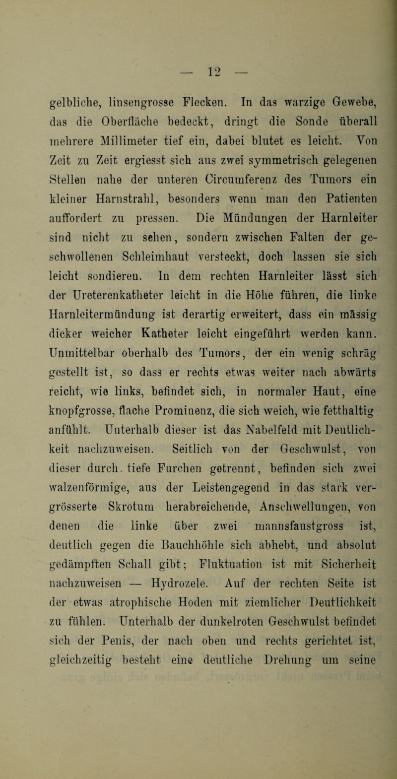 gelbliche, linsengrosse Flecken. In das warzige Gewebe, das die Oberfläche bedeckt, dringt die Sonde überall mehrere Millimeter tief ein, dabei blutet es leicht. Von Zeit zu Zeit ergiesst sich aus zwei symmetrisch gelegenen Stellen nahe der unteren Circumferenz des Tumors ein kleiner Harnstrahl, besonders wenn man den Patienten auffordert zu pressen. Die Mündungen der Harnleiter sind nicht zu sehen, sondern zwischen Falten der ge¬ schwollenen Schleimhaut versteckt, doch lassen sie sich leicht sondieren. In dem rechten Harnleiter lässt sich der Ureterenkatheter leicht in die Höhe führen, die linke Harnleitermündung ist derartig erweitert, dass ein mässig dicker weicher Katheter leicht eingeführt werden kann. Unmittelbar oberhalb des Tumors, der ein wenig schräg gestellt ist, so dass er rechts etwas weiter nach abwärts reicht, wie links, befindet sich, in normaler Haut, eine knopfgrosse, flache Prominenz, die sich weich, wie fetthaltig anfühlt. Unterhalb dieser ist das Nabelfeld mit Deutlich¬ keit nachzuweisen. Seitlich von der Geschwulst, von dieser durch, tiefe Furchen getrennt, befinden sich zwei walzenförmige, aus der Leistengegend in das stark ver- grösserte Skrotum herabreichende, Anschwellungen, von denen die linke über zwei mannsfaustgross ist, deutlich gegen die Bauchhöhle sich abhebt, und absolut gedämpften Schall gibt; Fluktuation ist mit Sicherheit nachzuweisen — Hydrozele. Auf der rechten Seite ist der etwas atrophische Hoden mit ziemlicher Deutlichkeit zu fühlen. Unterhalb der dunkelroten Geschwulst befindet sich der Penis, der nach oben und rechts gerichtet ist, gleichzeitig besteht eine deutliche Drehung um seine