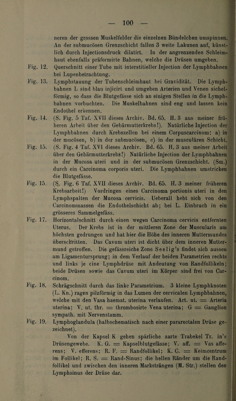 Fig. 12. Fig. 13. 14. Fig. 15. Fig. 15. Fig. 17, Fig. 18. Fig. 19. neren der grossen Muskelfelder die einzelnen Bündelchen umspinnen. An der submucösen Grenzschicht fallen 3 weite Lakunen auf, künst¬ lich durch Injectionsdruck dilatirt. In der angrenzenden Schleim¬ haut ebenfalls präformirte Bahnen, welche die Drüsen umgeben. Querschnitt einer Tube mit interstitieller Injection der Lymphbahnen bei Lupenbetrachtung. Lymphstauung der Tubenschleimhaut bei Gravidität. Die Lymph¬ bahnen L sind blau injicirt und umgeben Arterien und Venen sichel¬ förmig, so dass die Blutgefässe sich an einigen Stellen in die Lymph¬ bahnen vorbuchten. Die Muskelbahnen sind eng und lassen kein Endothel erkennen. (S. Fig. 5 Taf. XVII dieses Archiv. Bd. 65. H. 3 aus meiner frü¬ heren Arbeit über den Gebärmutterkrebs!). Natürliche Injection der Lymphbahnen durch Krebszellen bei einem Corpuscarcinom: a) in der mucösen, b) in der submucösen, c) in der musculären Schicht. (S. Fig. 4 Taf. XVI dieses Archiv. Bd. 65. H. 3 aus meiner Arbeit über den Gebärmutterkrebs!) Natürliche Injection der Lymphbahnen in der Mucosa uteri und in der submucösen Grenzschicht. (Sm.) durch ein Carcinoma corporis uteri. Die Lymphbahnen umstricken die Blutgefässe. (S. Fig. 6 Taf. XVII dieses Archiv. Bd. 65. H. 3 meiner früheren Krebsarbeit!) Vordringen eines Carcinoma portionis uteri in den Lymphspalten der Mucosa cervicis. Ueberall hebt sich von den Carcinommassen die Endothelschicht ab; bei L. Einbruch in ein grösseres Sammelgefäss. Horizontalschnitt durch einen wegen Carcinoma cervicis entfernten Uterus. Der Krebs ist in der mittleren Zone der Muscularis am höchsten gedrungen und hat hier die Höhe des inneren Muttermundes überschritten. Das Cavum uteri ist dicht über dem inneren Mutter¬ mund getroffen. Die gefässreiche Zone Seelig’s findet sich aussen am Ligamentursprung; in dem Verlauf der beiden Parametrien rechts und links je eine Lymphdrüse mit Andeutung von Randfollikeln; beide Drüsen sowie das Cavum uteri im Körper sind frei von Car- cinom. Schrägschnitt durch das linke Parametrium. 3 kleine Lymphknoten (L. Kn.) ragen pilzförmig in das Lumen der eervicalen Lymphbahnen, welche mit den Vasa haemat. uterina verlaufen. Art. ut. = Arteria uterina; V. ut. thr. = thrombosirte Vena uterina; G = Ganglion sympath. mit Nervenstamm. Lymphoglandula (halbschematisch nach einer pararectalen Drüse ge¬ zeichnet). Von der Kapsel K gehen spärliche zarte Trabekel Tr. in’s Drüsengewebe. K. G. = Kapselblutgefässe; V. aff. = Vas affe- rens; V. efferens; R. F. = Randfollikel; K. C. = Keimcentrum im Follikel; R. S. — Rand-Sinus; die hellen Ränder um die Rand¬ follikel und zwischen den inneren Marksträngen (M. Str.) stellen den Lymphsinus der Drüse dar.
