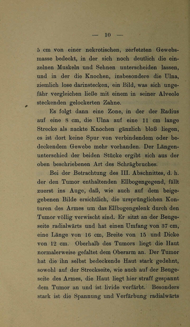 5 cm von einer nekrotischen, zerfetzten Gewebs- masse bedeckt, in der sich noch deutlich die ein¬ zelnen Muskeln und Sehnen unterscheiden lassen, und in der die Knochen, insbesondere die Ulna, ziemlich lose darinstecken, ein Bild, was sich unge¬ fähr vergleichen ließe mit einem in seiner Alveole steckenden gelockerten Zahne. Es folgt dann eine Zone, in der der Radius auf eine 8 cm, die Ulna auf eine 11 cm lange Strecke als nackte Knochen gänzlich bloß liegen, es ist dort keine Spur von verbindendem oder be¬ deckendem Gewebe mehr vorhanden. Der Längen¬ unterschied der beiden Stücke ergibt sich aus der oben beschriebenen Art des Schrägbruches. Bei der Betrachtung des III. Abschnittes, d. h. der den Tumor enthaltenden Ellbogengegend, fällt zuerst ins Auge, daß, wie auch auf dem beige¬ gebenen Bilde ersichtlich, die ursprünglichen Kon¬ turen des Armes um das Ellbogengelenk durch den Tumor völlig verwischt sind. Er sitzt an der Beuge¬ seite radialwärts und hat einen Umfang von 37 cm, eine Länge von 16 cm, Breite von 15 und Dicke von 12 cm. Oberhalb des Tumors liegt die Haut normalerweise gefaltet dem Oberarm an. Der Tumor hat die ihn selbst bedeckende Haut stark gedehnt, sowohl auf der Streckseite, wie auch auf der Beuge¬ seite des Armes, die Haut liegt hier straff gespannt dem Tumor an und ist livide verfärbt. Besonders stark ist die Spannung und Verfärbung radialwärts