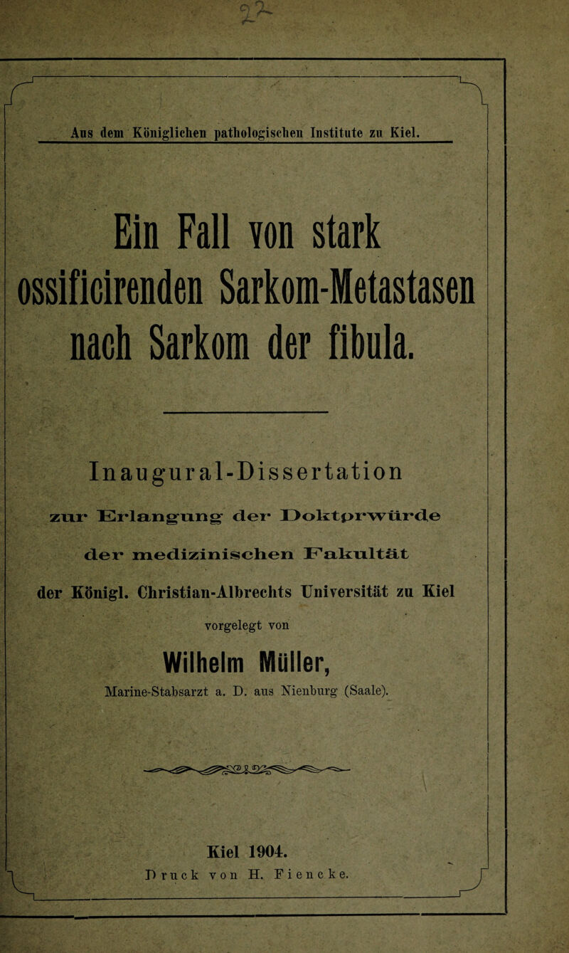 Ein Fall von stark ossificirenden Sarkom-Metastasen nach Sarkom der fibula. Inaugural-Dissertation zur Erlangung der I) ol£ tpr* wüi*de der medizinischen Fakultät der Königl. Christian-Albrechts Universität zu Kiel vorgelegt von Wilhelm Müller, Marine-Stabsarzt a. D. aus Nienburg (Saale). Kiel 1904.