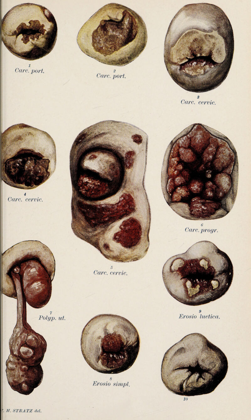 3 Care, cervic. f. H. STR ATZ del. JO