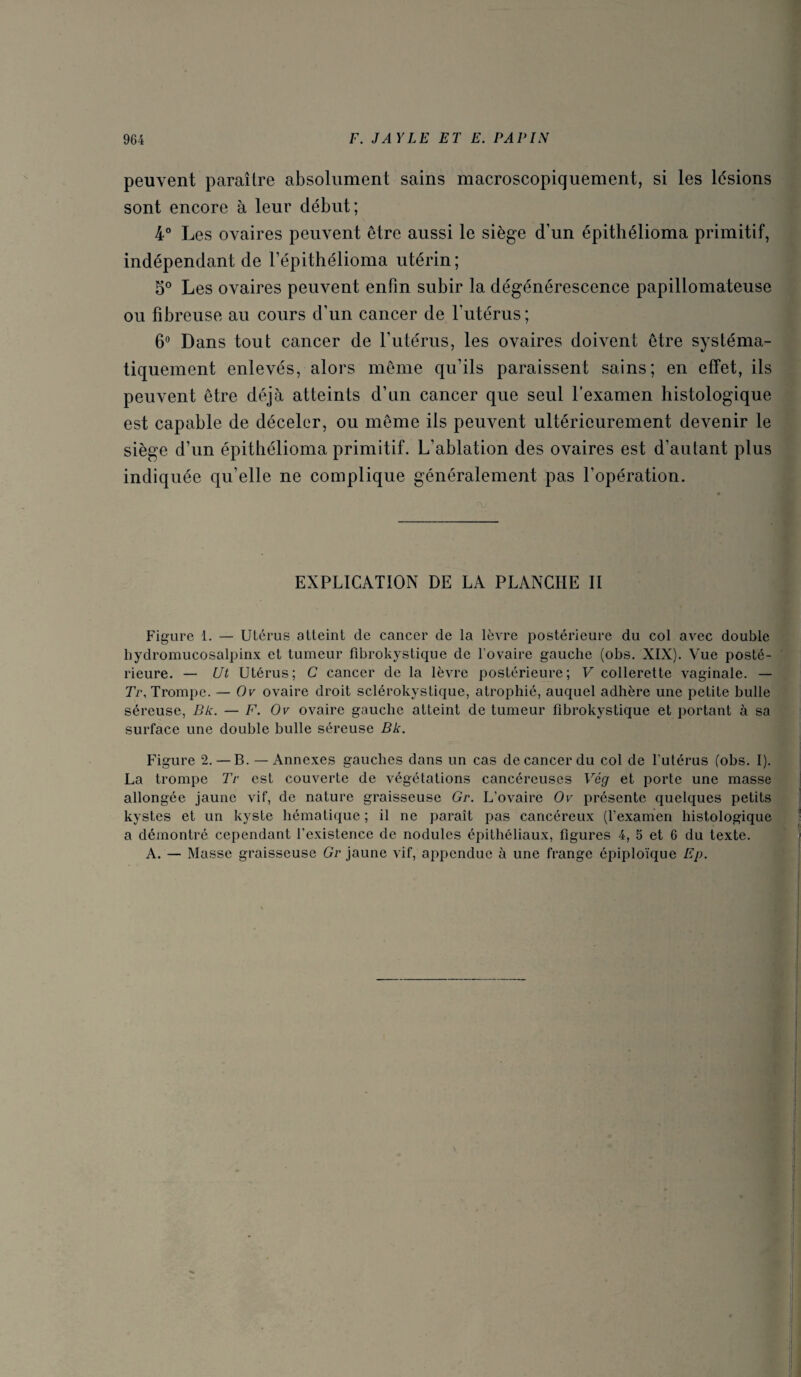 peuvent paraître absolument sains macroscopiquement, si les lésions sont encore à leur début; 4° Les ovaires peuvent être aussi le siège d’un épithélioma primitif, indépendant de Fépithélioma utérin; 5® Les ovaires peuvent enfin subir la dégénérescence papillomateuse ou fibreuse au cours d’un cancer de l’utérus; 6'^ Dans tout cancer de l’utérus, les ovaires doivent être systéma¬ tiquement enlevés, alors même qu’ils paraissent sains; en effet, ils peuvent être déjà atteints d’un cancer que seul l’examen histologique est capable de déceler, ou même ils peuvent ultérieurement devenir le siège d’un épithélioma primitif. L’ablation des ovaires est d’autant plus indiquée qu’elle ne complique généralement pas l’opération. EXPLICATION DE LA PLANCHE II Figure 1. — Utérus atteint de cancer de la lèvre postérieure du col avec double bydromucosalpinx et tumeur fibrokystique de l’ovaire gauche (obs. XIX). Vue posté¬ rieure. — Ut Utérus; C cancer de la lèvre postérieure; V collerette vaginale. — T'r, Trompe. — Or ovaire droit sclérokystique, atrophié, auquel adhère une petite bulle séreuse, Bk. — F. O v ovaire gauche atteint de tumeur fibrokystique et portant à sa surface une double bulle séreuse Bk. Figure 2. — B. — Annexes gauches dans un cas de cancer du col de l'utérus (obs. I). La trompe Tr est couverte de végétations cancéreuses Vég et porte une masse allongée jaune vif, de nature graisseuse Gr. L’ovaire Ov présente quelques petits kystes et un kyste hématique ; il ne paraît pas cancéreux (l’examen histologique a démontré cependant l’existence de nodules épithéliaux, figures 4, 5 et 6 du texte. A. — Masse graisseuse Gr jaune vif, appendue à une frange épiploïque Ep. \ I