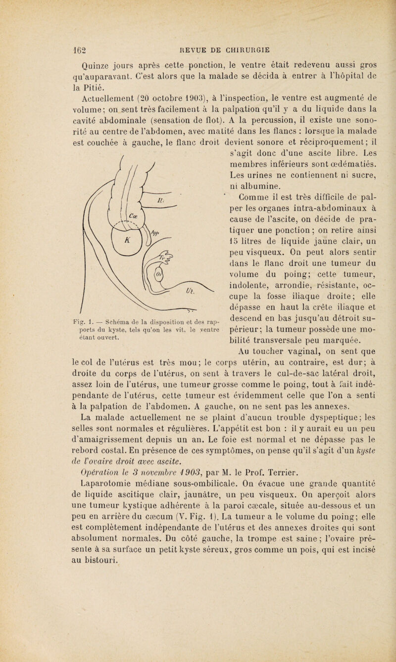 Quinze jours après cette ponction, le ventre était redevenu aussi gros qu’auparavant. C’est alors que la malade se décida à entrer à l’hôpital de la Pitié. Actuellement (20 octobre 1903), à l’inspection, le ventre est augmenté de volume; on sent très facilement à la palpation qu’il y a du liquide dans la cavité abdominale (sensation de Ilot). A la percussion, il existe une sono¬ rité au centre de l’abdomen, avec matité dans les flancs : lorsque la malade est couchée à gauche, le flanc droit devient sonore et réciproquement; il s’agit donc d’une ascite libre. Les membres inférieurs sont œdématiés. Les urines ne contiennent ni sucre, ni albumine. Comme il est très difficile de pal¬ per les organes intra-abdominaux à cause de l’ascite, on décide de pra¬ tiquer une ponction ; on retire ainsi 15 litres de liquide jaune clair, un peu visqueux. On peut alors sentir dans le flanc droit une tumeur du volume du poing; cette tumeur, indolente, arrondie, résistante, oc¬ cupe la fosse iliaque droite; elle dépasse en haut la crête iliaque et descend en bas jusqu’au détroit su¬ périeur; la tumeur possède une mo¬ bilité transversale peu marquée. Au toucher vaginal, on sent que le col de l’utérus est très mou; le corps utérin, au contraire, est dur; à droite du corps de l’utérus, on sent à travers le cul-de-sac latéral droit, assez loin de l’utérus, une tumeur grosse comme le poing, tout à fait indé¬ pendante de l’utérus, cette tumeur est évidemment celle que l’on a senti à la palpation de l’abdomen. A gauche, on ne sent pas les annexes. La malade actuellement ne se plaint d’aucun trouble dyspeptique ; les selles sont normales et régulières. L’appétit est bon : il y aurait eu un peu d’amaigrissement depuis un an. Le foie est normal et ne dépasse pas le rebord costal. En présence de ces symptômes, on pense qu’il s’agit d’un kyste de Vovaire droit avec ascite. Opération le 3 novembre 4 903, par M. le Prof. Terrier. Laparotomie médiane sous-ombilicale. On évacue une grande quantité de liquide ascitique clair, jaunâtre, un peu visqueux. On aperçoit alors une tumeur kystique adhérente à la paroi cæcale, située au-dessous et un peu en arrière du cæcum (Y. Fig. 1). La tumeur a le volume du poing; elle est complètement indépendante de l’utérus et des annexes droites qui sont absolument normales. Du côté gauche, la trompe est saine ; l’ovaire pré¬ sente à sa surface un petit kyste séreux, gros comme un pois, qui est incisé au bistouri. Fig. 1. — Schéma de la disposition et des rap¬ ports du kyste, tels qu’on les vit, le ventre étant ouvert.