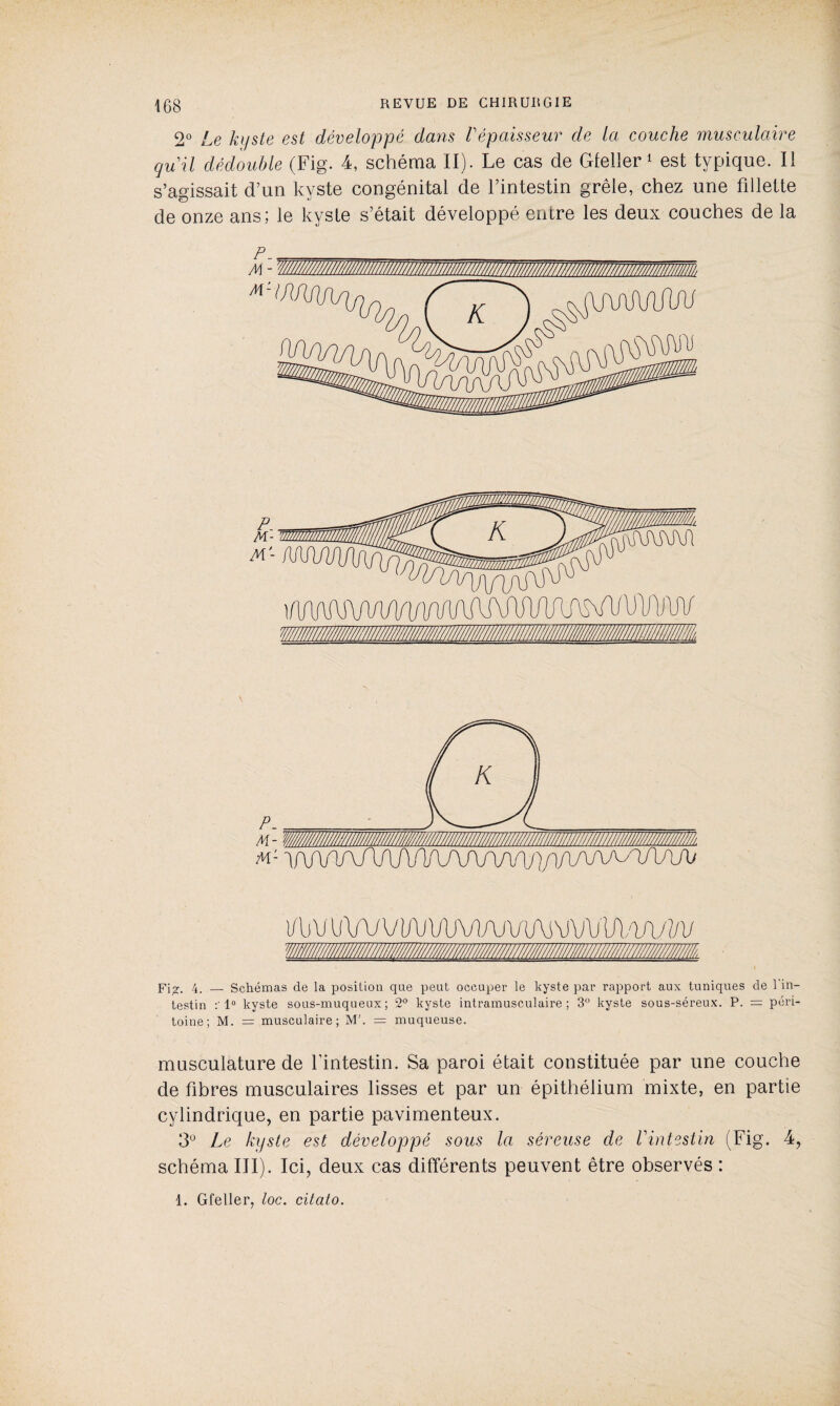 2° Le ki/ste est développé dans Vépaisseur de la couche musculaire gu il dédouble (Fig. 4, schéma II). Le cas de Gfeller 1 est typique. II s’agissait d’un kyste congénital de l’intestin grêle, chez une fillette de onze ans; le kyste s’était développé entre les deux couches de la P___ i/b v \iwvvv\AMAj\m\)vvv}.w/vi/ 'wtiiiimm/m/iikm//////////////m////m Fi*. 4. — Schémas de la position que peut occuper le kyste par rapport aux tuniques de 1 in¬ testin 1° kyste sous-muqueux; 2° kyste intramusculaire; 3° kyste sous-séreux. P. = péri¬ toine; M. = musculaire; M'. = muqueuse. musculature de l'intestin. Sa paroi était constituée par une couche de fibres musculaires lisses et par un épithélium mixte, en partie cylindrique, en partie pavimenteux. 3° Le kyste est développé sous la séreuse de Vintestin (Fig. 4, schéma III). Ici, deux cas différents peuvent être observés : 1. Gfeller, toc. citato.