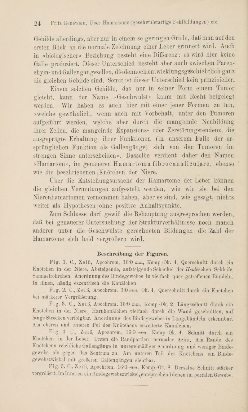 Gebilde allerdings, aber nur in einem so geringen Grade, daß man auf den ersten Blick an die normale Zeichnung einer Leber erinnert wird. Auch in »biologischer« Beziehung besteht eine Differenz: es wird hier keine Galle produziert. Dieser Unterschied besteht aber auch zwischen Paren¬ chym- und Gallengangszellen, die dennoch.entwickhingsgeschichtlich ganz die gleichen Gebilde sind. Somit ist dieser Unterschied kein prinzipieller. Einem solchen Gebilde, das nur in seiner Form einem Tumor gleicht, kann der Name »Geschwulst« kaum mit Becht beigelegt werden. Wir haben es auch hier mit einer jener Formen zu tun, »welche gewöhnlich, wenn auch mit Vorbehalt, unter den Tumoren aufgeführt werden, welche aber durch die mangelnde Neubildung ihrer Zellen, die mangelnde Expansions- oder Zerstörungstendenz, die ausgeprägte Erhaltung ihrer Funktionen (in unserem Falle der ur¬ sprünglichen Funktion als Gallengänge) sich von den Tumoren im strengen Sinne unterscheiden«. Dasselbe verdient daher den Namen »Hamartom«, im genaueren Hamartoma fibrocanalicuiare, ebenso wie die beschriebenen Knötchen der Niere. Über die Entstehungsursache der Hamartome der Leber können die gleichen Vermutungen aufgestellt werden, wie wir sie bei den Nierenhamartomen vernommen haben, aber es sind, wie gesagt, nichts weiter als Hypothesen ohne positive Anhaltspunkte. Zum Schlüsse darf gewiß die Behauptung ausgesprochen werden, daß bei genauerer Untersuchung der Strukturverhältnisse noch manch anderer unter die Geschwülste gerechneten Bildungen die Zahl der Hamartome sich bald vergrößern wird. Beschreibung der Figuren. Fig. 1. 0., Zeiß, Apoclirom. 16*0 mm, Komp.-Ok. 4. Querschnitt durch ein Knötchen in der Niere. Absteigende, aufsteigende Schenkel der fezfeschen Schleife. Sammelröhrehen. Anordnung des Bindegewebes in vielfach quer getroffenen Bündeln. In ihnen, häufig exzentrisch die Kanälchen. Fig. 2. 0, Zeiß, Apoclirom. 3-0 mm, Ok. 4. Querschnitt durch ein Knötchen bei stärkerer Vergrößerung. Fig. 3. C., Zeiß, Apoclirom. lß'O mm, Komp.-Ok. 2. Längsschnitt durch ein Knötchen in der Niere. Harnkanälchen vielfach durch die Wand geschnitten, auf lange Strecken verfolgbar. Anordnung des Bindegewebes in Längsbündeln erkennbar. Am oberen und unteren Pol des Knötchens erweiterte Kanälchen. Fig. 4. 0., Zeiß, Apoclirom. 16’0 mm, Komp.-Ok. 4. Schnitt durch ein Knötchen in der Leber. Unten die Randpartien normaler Azini. Am Rande des Knötchens reichliche Gallengänge in unregelmäßiger Anordnung und weniger Binde¬ gewebe als gegen das Zentrum zu. Am unteren Teil des Knötchens ein Binde- gewebszwiekel mit größeren Gallengängen sichtbar. Fig. 5. 0., Zeiß, Apoclirom. 16'0 mm, Komp.-Ok. 8. Derselbe Schnitt stärker vergrößert. Im Inneren ein Bindegewebszwickel, entsprechend denen im portalen Gewebe.