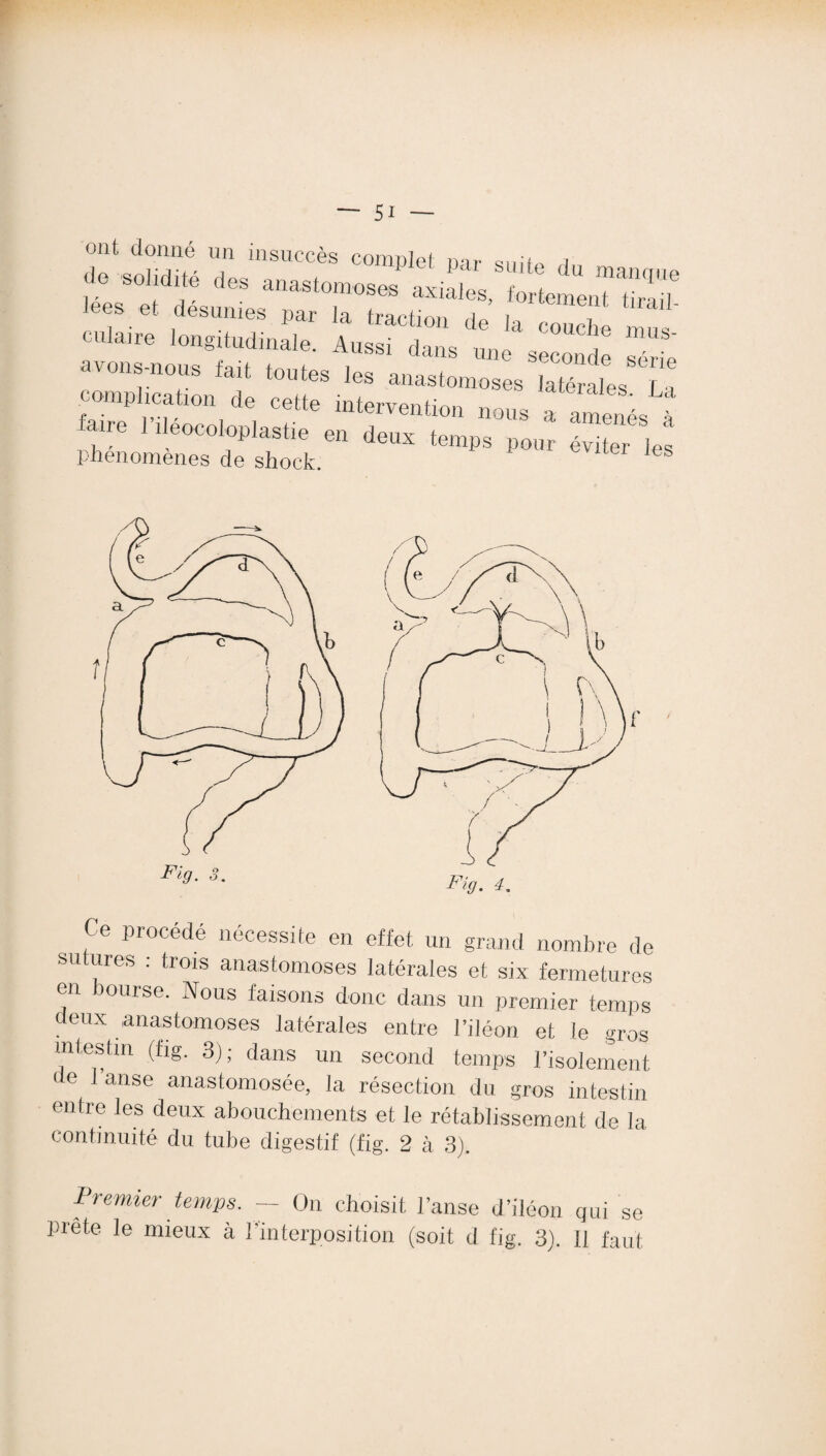 ont donné un insuccès complet mr Q,,im i p <>» lees et désunies par la traction de I, ' culaire longitudinale. Aussi dans une seconde série von s-nous tait toutes les anastomoses latérales La complication de cette intervention nous a amenés à , l‘Jeocotoplasfae en deux temps pour éviter les phénomènes de shock. Ies e procédé nécessite en effet un grand nombre de sutures : trois anastomoses latérales et six fermetures en bourse. Nous faisons donc dans un premier temps deux anastomoses latérales entre l’iléon et le gros intestin (fig. 3); dans un second temps l’isolement e 1 anse anastomosée, la résection du gros intestin entre les deux abouchements et le rétablissement de la continuité du tube digestif (fig. 2 à 3). Premier temps. — On choisit prête le mieux à l’interposition 1 anse d’iléon qui se (soit d lig. 3). il faut