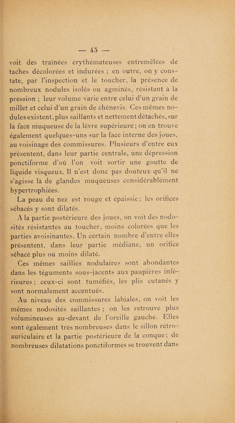 voit des traînées érythémateuses entremêlées de taches décolorées et indurées ; en outre, on y cons¬ tate, par l’inspection et le toucher, la présence de nombreux nodules isolés ou agminés, résistant à la pression ; leur volume varie entre celui d’un grain de millet et celui d’un grain de chènevis. Ces mêmes no¬ dules existent, plus saillants et nettement détachés, sur la face muqueuse de la lèvre supérieure; on en trouve également quelques-uns sur la face interne des joues, au voisinage des commissures. Plusieurs d’entre eux présentent, dans leur partie centrale, une dépression ponctiforme d’où l’on voit sortir une goutte de liquide visqueux. Il n’est donc pas douteux*qu’il ne s’agisse là de glandes muqueuses considérablement hypertrophiées. La peau du nez est rouge et épaissie ; les orifices sébacés y sont dilatés. A la partie postérieure des joues, on voit des nodo¬ sités résistantes au toucher, moins colorées que les parties avoisinantes. Un certain nombre d’entre elles présentent, dans leur partie médiane, un orifice sébacé plus ou moins dilaté. Ces mêmes saillies nodulaires sont abondantes dans les téguments sous-jacents aux paupières infé¬ rieures ; ceux-ci sont tuméfiés, les plis cutanés y sont normalement accentués. Au niveau des commissures labiales, on voit les mêmes nodosités saillantes ; on les retrouve plus volumineuses au-devant de l’oreille gauche. Plies sont également très nombreuses dans le sillon rétro- auriculaire et la partie postérieure de la conque; de nombreuses dilatations ponctiformes se trouvent dans