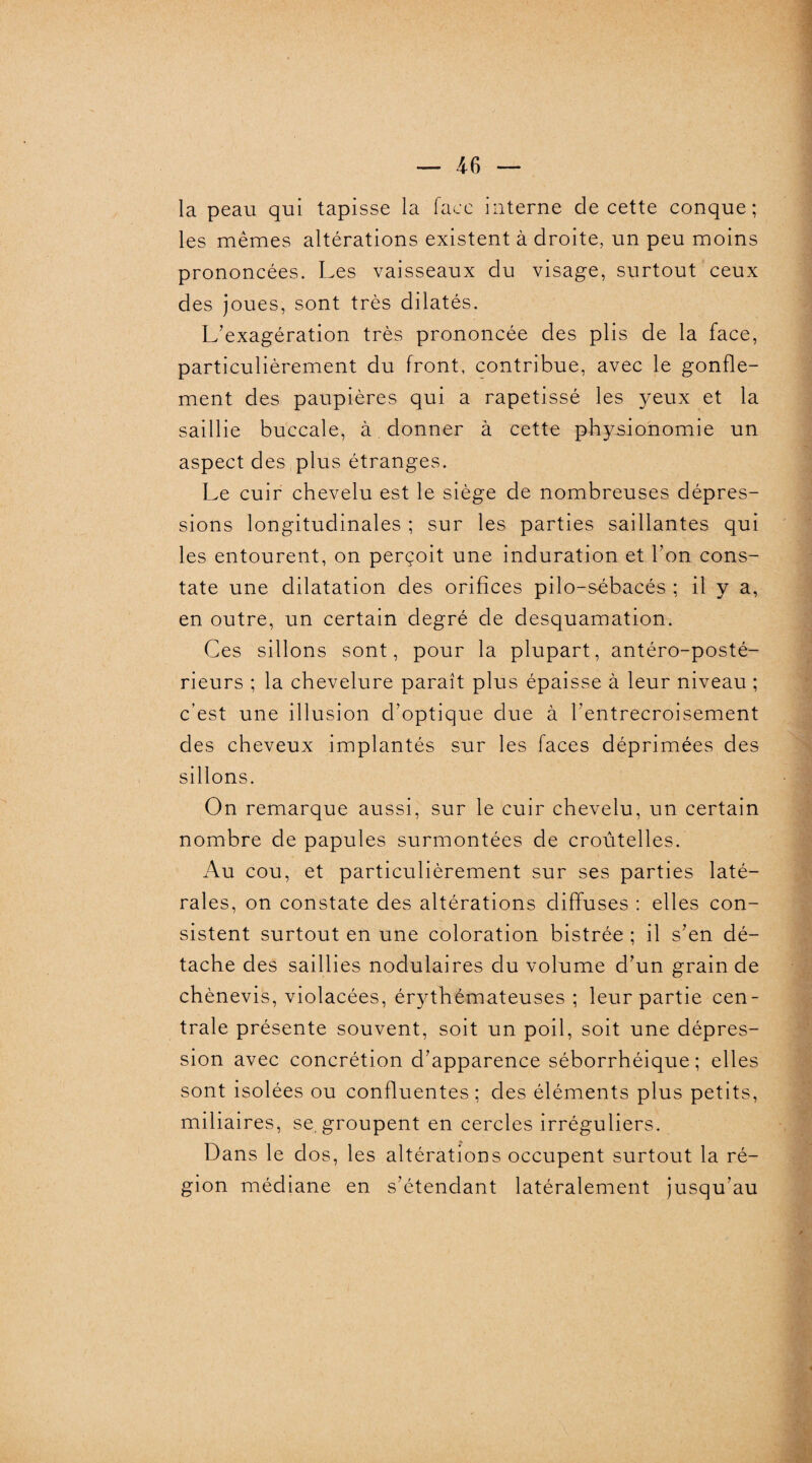 la peau qui tapisse la face interne de cette conque; les mêmes altérations existent à droite, un peu moins prononcées. Les vaisseaux du visage, surtout ceux des joues, sont très dilatés. L’exagération très prononcée des plis de la face, particulièrement du front, contribue, avec le gonfle¬ ment des paupières qui a rapetissé les yeux et la saillie buccale, à donner à cette physionomie un aspect des plus étranges. Le cuir chevelu est le siège de nombreuses dépres¬ sions longitudinales ; sur les parties saillantes qui les entourent, on perçoit une induration et l’on cons¬ tate une dilatation des orifices pilo-sébacés ; il y a, en outre, un certain degré de desquamation. Ces sillons sont, pour la plupart, antéro-posté¬ rieurs ; la chevelure paraît plus épaisse à leur niveau ; c’est une illusion d’optique due à l’entrecroisement des cheveux implantés sur les faces déprimées des sillons. On remarque aussi, sur le cuir chevelu, un certain nombre de papules surmontées de croûtelles. Au cou, et particulièrement sur ses parties laté¬ rales, on constate des altérations diffuses : elles con¬ sistent surtout en une coloration bistrée ; il s’en dé¬ tache des saillies nodulaires du volume d’un grain de chènevis, violacées, érythémateuses ; leur partie cen¬ trale présente souvent, soit un poil, soit une dépres¬ sion avec concrétion d’apparence séborrhéique; elles sont isolées ou confluentes ; des éléments plus petits, miliaires, se, groupent en cercles irréguliers. Dans le dos, les altérations occupent surtout la ré¬ gion médiane en s’étendant latéralement jusqu’au