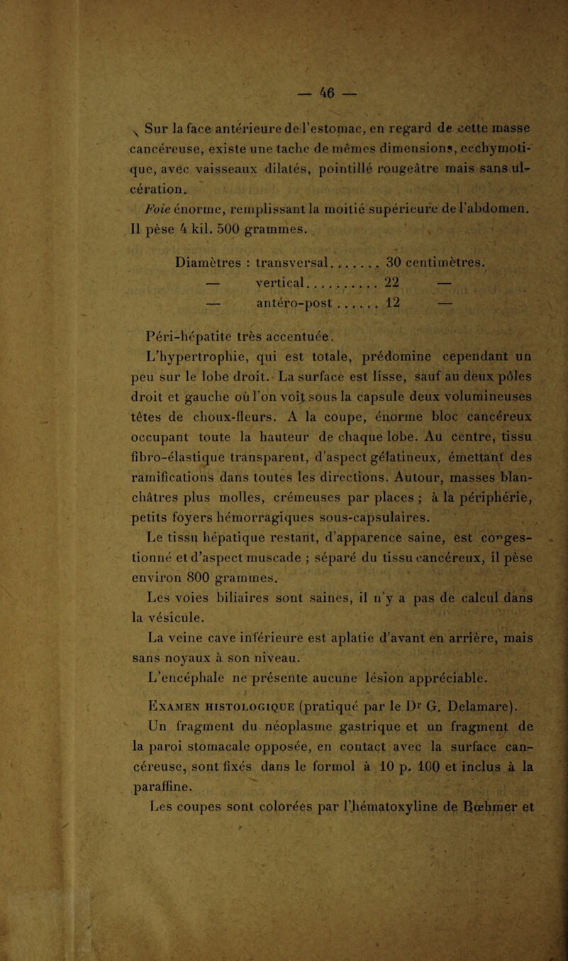 cancéreuse, existe une tache de mêmes dimensions, ecchymoti- que, avec vaisseaux dilatés, pointillé rougeâtre mais sans ul¬ cération. Foie énorme, remplissant la moitié supérieure de l’abdomen. Il pèse 4 kil. 500 grammes. Diamètres : transversal. — vertical.... — antéro-post Péri-hépatite très accentuée . L’hypertrophie, qui est totale, prédomine cependant un peu sur le lobe droit. La surface est lisse, sauf au deux pôles droit et gauche où l’on voit sous la capsule deux volumineuses têtes de choux-fleurs. A la coupe, énorme bloc cancéreux occupant toute la hauteur de chaque lobe. Au centre, tissu fibro-élastique transparent, d’aspect gélatineux, émettant des ramifications dans toutes les directions. Autour, masses blan¬ châtres plus molles, crémeuses par places ; à la périphérie, petits foyers hémorragiques sous-capsulaires. Le tissu hépatique restant, d’apparence saine, est conges¬ tionné et d’aspect muscade ; séparé du tissu cancéreux, il pèse environ 800 grammes. Les voies biliaires sont saines, il n’y a pas de calcul dans la vésicule. La veine cave inférieure est aplatie d’avant en arrière, mais sans no}raux à son niveau. L’encéphale ne présente aucune lésion appréciable. Examen histologique (pratiqué par le Dr G. Delamare). Un fragment du néoplasme gastrique et un fragment de la paroi stomacale opposée, en contact avec la surface can¬ céreuse, sont fixés dans le formol à 10 p. 100 et inclus à la paraffine. Les coupes sont colorées par l’hématoxyline de Bœhmer et 30 centimètres. 22 — 12