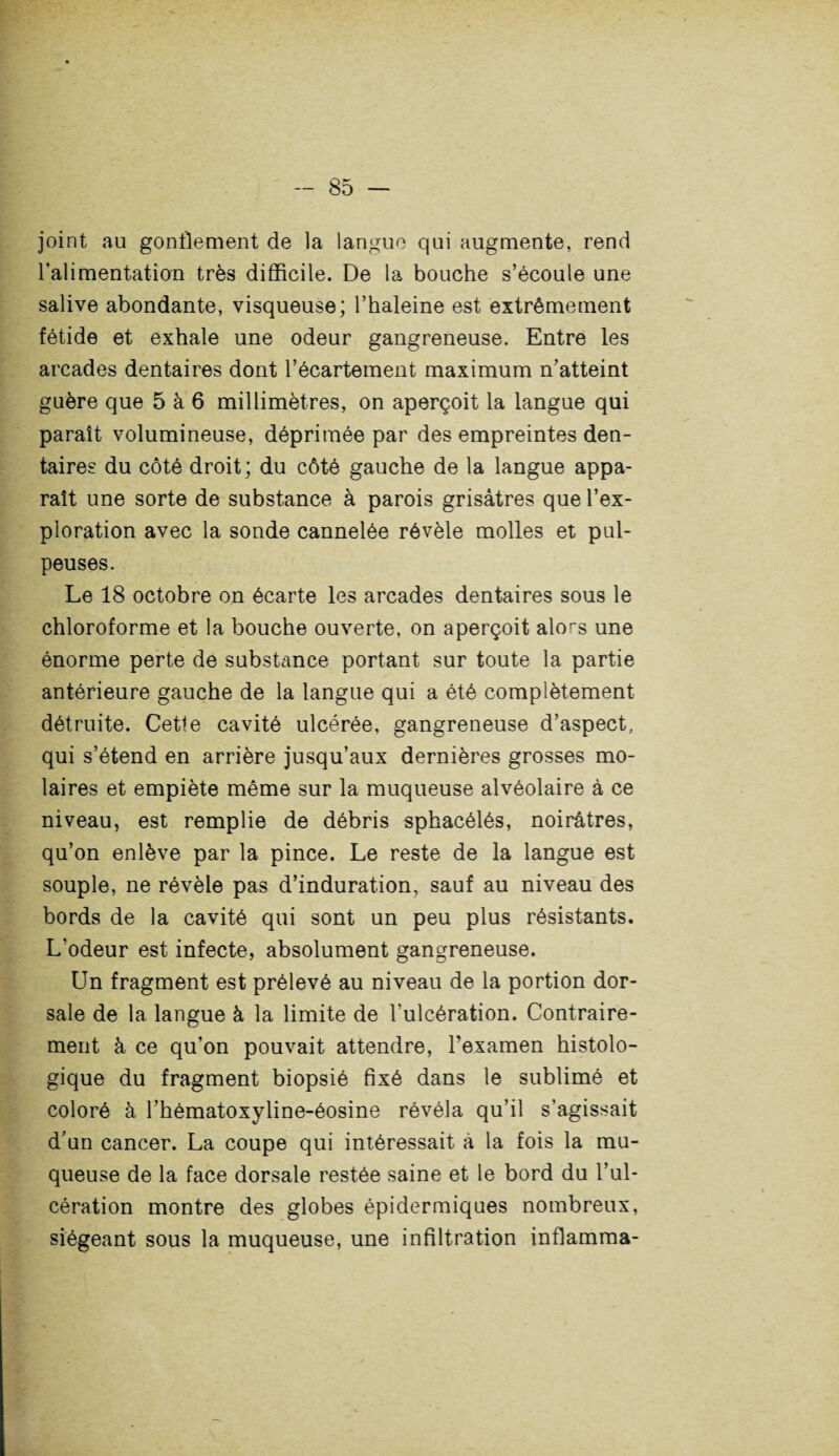 joint au gonflement de la langue qui augmente, rend l’alimentation très difficile. De la bouche s’écoule une salive abondante, visqueuse; l’haleine est extrêmement fétide et exhale une odeur gangreneuse. Entre les arcades dentaires dont l’écartement maximum n’atteint guère que 5 à 6 millimètres, on aperçoit la langue qui paraît volumineuse, déprimée par des empreintes den¬ taires du côté droit ; du côté gauche de la langue appa¬ raît une sorte de substance à parois grisâtres que l’ex¬ ploration avec la sonde cannelée révèle molles et pul¬ peuses. Le 18 octobre on écarte les arcades dentaires sous le chloroforme et la bouche ouverte, on aperçoit alors une énorme perte de substance portant sur toute la partie antérieure gauche de la langue qui a été complètement détruite. Cette cavité ulcérée, gangreneuse d’aspect, qui s’étend en arrière jusqu’aux dernières grosses mo¬ laires et empiète même sur la muqueuse alvéolaire à ce niveau, est remplie de débris sphacélés, noirâtres, qu’on enlève par la pince. Le reste de la langue est souple, ne révèle pas d’induration, sauf au niveau des bords de la cavité qui sont un peu plus résistants. L’odeur est infecte, absolument gangreneuse. Un fragment est prélevé au niveau de la portion dor¬ sale de la langue à la limite de l'ulcération. Contraire¬ ment à ce qu’on pouvait attendre, l’examen histolo¬ gique du fragment biopsié fixé dans le sublimé et coloré à l’hématoxyline-éosine révéla qu’il s’agissait d’un cancer. La coupe qui intéressait à la fois la mu¬ queuse de la face dorsale restée saine et le bord du l’ul¬ cération montre des globes épidermiques nombreux, siégeant sous la muqueuse, une infiltration inflamma-