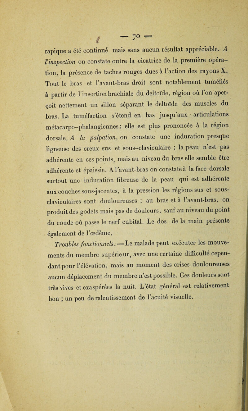 — 7° — rapique a été continue mais sans aucun résultat appréciable. .A ïinspection on constate outre la cicatrice de la première opéra¬ tion, la présence de taches rouges dues a 1 action des rayons X. Tout le bras et l’avant-bras droit sont notablement tuméfiés à partir de l’insertion brachiale du deltoïde, région où 1 on aper¬ çoit nettement un sillon séparant le deltoïde des muscles du bras. La tuméfaction s’étend en bas jusqu’aux articulations métacarpo-phalangiennes ; elle est plus prononcée à la région dorsale. A la palpation, on constate une induration presque ligneuse des creux sus et sous-claviculaire ; la peau n’est pas adhérente en ces points, mais au niveau du bras elle semble être adhérente et épaissie* A l’avant-bras on constate à la face dorsale surtout une induration fibreuse de la peau qui est adhérente aux couches sous-jacentes, à la pression les régions sus et sous- claviculaires sont douloureuses ; au bras et a 1 avant-bras, on produit des godets mais pas de douleurs, sauf au niveau du point du coude où passe le nerf cubital. Le dos de la main présente également de l’oedème. Troubles fonctionnels. — Le malade peut exécuter les mouve¬ ments du membre supérieur, avec une certaine difficulté cepen¬ dant pour l’élévation, mais au moment des crises douloureuses aucun déplacement du membre n’est possible. Ces douleurs sont très vives et exaspérées la nuit. L’état général est relativement bon ; un peu de ralentissement de l’acuité visuelle.