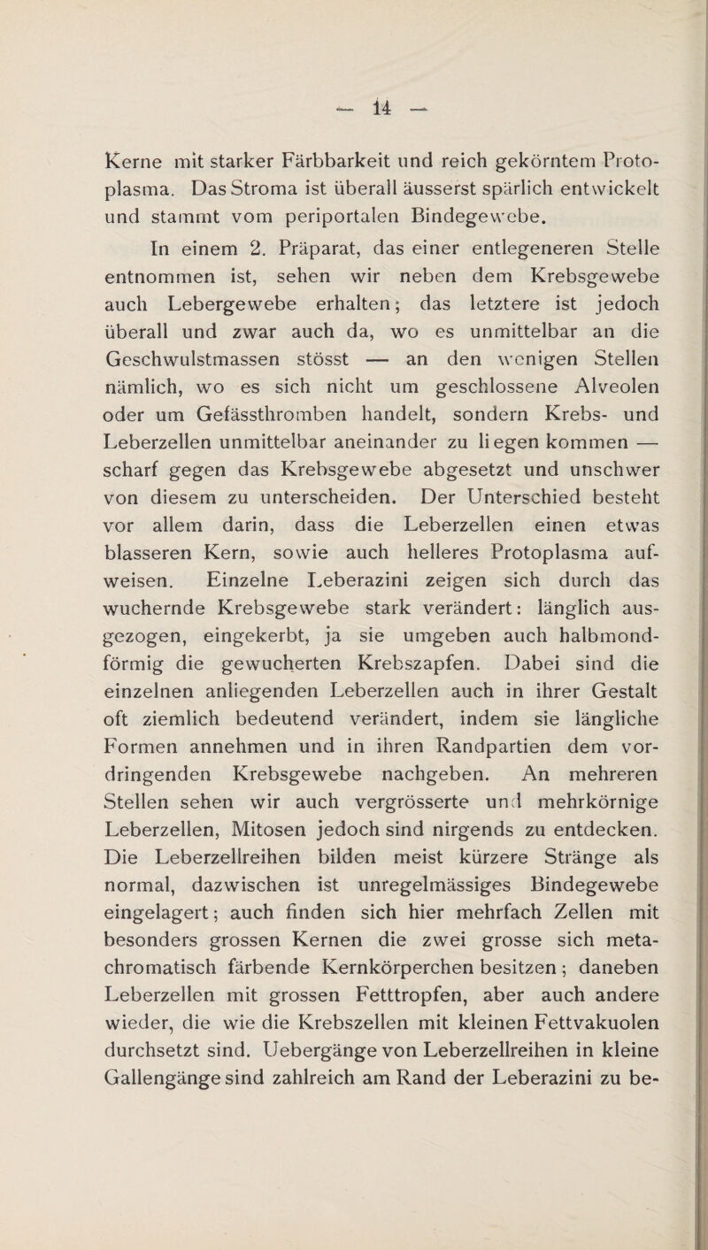 Kerne mit starker Färbbarkeit und reich gekörntem Proto¬ plasma. Das Stroma ist überall äusserst spärlich entwickelt und stammt vom periportalen Bindegewebe. In einem 2. Präparat, das einer entlegeneren Stelle entnommen ist, sehen wir neben dem Krebsgewebe auch Lebergewebe erhalten; das letztere ist jedoch überall und zwar auch da, wo es unmittelbar an die Geschwulstmassen stösst — an den wenigen Stellen nämlich, wo es sich nicht um geschlossene Alveolen oder um Gefässthromben handelt, sondern Krebs- und Leberzellen unmittelbar aneinander zu liegen kommen — scharf gegen das Krebsgewebe abgesetzt und unschwer von diesem zu unterscheiden. Der Unterschied besteht vor allem darin, dass die Leberzellen einen etwas blässeren Kern, sowie auch helleres Protoplasma auf¬ weisen. Einzelne Leberazini zeigen sich durch das wuchernde Krebsgewebe stark verändert: länglich aus¬ gezogen, eingekerbt, ja sie umgeben auch halbmond¬ förmig die gewucherten Krebszapfen. Dabei sind die einzelnen anliegenden Leberzellen auch in ihrer Gestalt oft ziemlich bedeutend verändert, indem sie längliche Formen annehmen und in ihren Randpartien dem vor¬ dringenden Krebsgewebe nachgeben. An mehreren Stellen sehen wir auch vergrösserte und mehrkörnige Leberzellen, Mitosen jedoch sind nirgends zu entdecken. Die Leberzellreihen bilden meist kürzere Stränge als normal, dazwischen ist unregelmässiges Bindegewebe eingelagert; auch finden sich hier mehrfach Zellen mit besonders grossen Kernen die zwei grosse sich meta¬ chromatisch färbende Kernkörperchen besitzen ; daneben Leberzellen mit grossen Fetttropfen, aber auch andere wieder, die wie die Krebszellen mit kleinen Fettvakuolen durchsetzt sind. Uebergänge von Leberzellreihen in kleine Gallengänge sind zahlreich am Rand der Leberazini zu be-