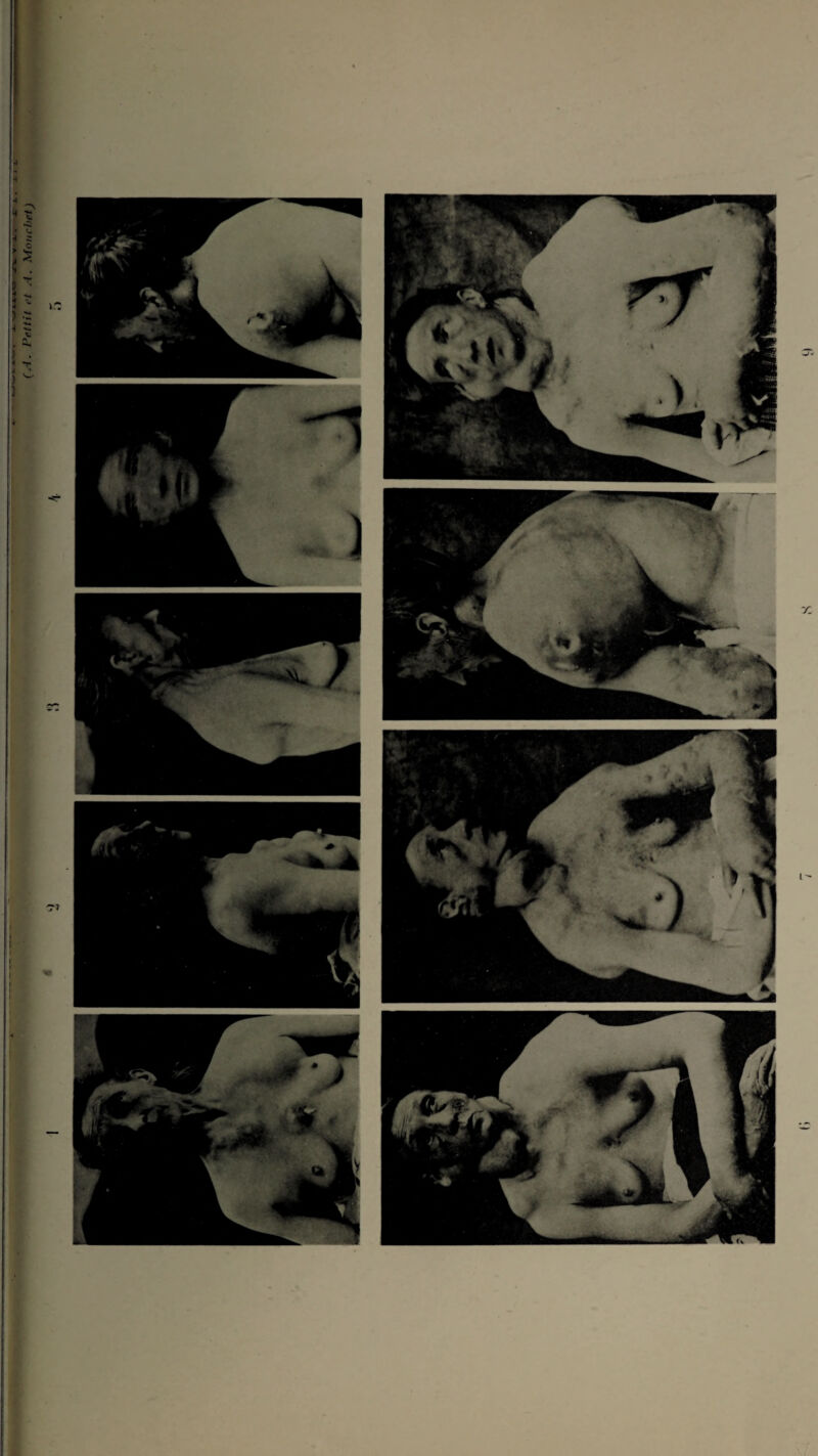 (^-l. Petiil et A. Mouchet) I I