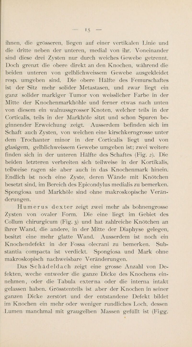 ihnen, die grösseren, liegen auf einer vertikalen Linie und die dritte neben der unteren, medial von ihr. Voneinander sind diese drei Zysten nur durch weiches (xewebe getrennt. Doch grenzt die obere direkt an den Knochen, während die beiden unteren von gelblichweissem Gewebe ausgekleidet resp. umgeben sind. Die obere Hälfte des Femurschaftes ist der Sitz mehr solider Metastasen, und zwar liegt ein ganz solider markiger Tumor von weisslicher Farbe in der Mitte der Knochenmarkhöhle und ferner etwas nach unten von diesem ein walnussgrosser Knoten, welcher teils in der Corticalis, teils in der Markhöle sitzt und schon Spuren be¬ ginnender Erweichung zeigt. Ausserdem befinden sich im Schaft auch Zysten, von welchen eine kirschkerngrosse unter dem Trochanter minor in der Corticalis liegt und von glasigem, gelblichweissem Gewebe umgeben ist; zwei weitere finden sich in der unteren Hälfte des vSchaftes (Fig. 2). Die beiden letzteren verbreiten sich teilweise in der Kortikalis, teilweise ragen sie aber auch in das Knochenmark hinein. Endlich ist noch eine Zyste, deren Wände mit Knötchen besetzt sind, im Bereich des Epicondylus medialis zu bemerken. Spongiosa und Markhöle sind ohne makroskopische Verän¬ derungen. Humerus dexter zeigt zwei mehr als bohnengrosse Zysten von ovaler Eorm. Die eine liegt im Gebiet des Collum chirurgicum (Eig. 3) und hat zahlreiche Knötchen an ihrer Wand, die andere, in der Mitte der Diaphyse gelegen, besitzt eine mehr glatte Wand. iVusserdem ist noch ein Knochen defekt in der Eossa olecrani zu bemerken. Sub- stantia compacta ist verdickt. Spongiosa und Mark ohne makroskopisch nachweisbare Veränderungen. Das Schädeldach zeigt eine grosse Anzahl von De¬ fekten, weche entweder die ganze Dicke des Knochens ein¬ nehmen, oder die Tabula externa oder die interna intakt gelassen haben. Grösstenteils ist aber der Knochen in seiner ganzen Dicke zerstört und der entstandene Defekt bildet im Knochen ein mehr oder weniger rundliches Loch, dessen Lumen manchmal mit graugelben Massen gefüllt ist (Eigg. t