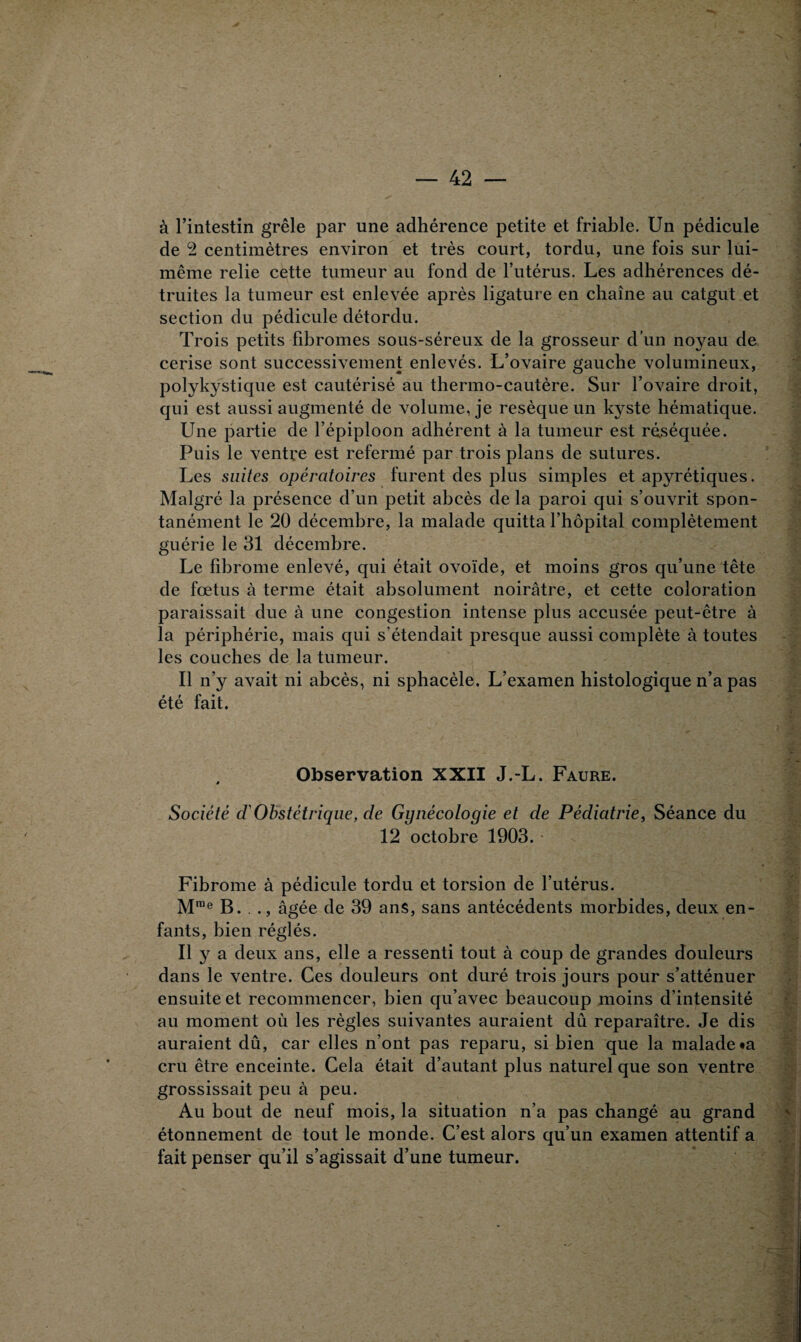 à l’intestin grêle par une adhérence petite et friable. Un pédicule de 2 centimètres environ et très court, tordu, une fois sur lui- même relie cette tumeur au fond de l’utérus. Les adhérences dé¬ truites la tumeur est enlevée après ligature en chaîne au catgut et section du pédicule détordu. Trois petits fibromes sous-séreux de la grosseur d’un noyau de cerise sont successivement enlevés. L’ovaire gauche volumineux, polykystique est cautérisé au thermo-cautère. Sur l’ovaire droit, qui est aussi augmenté de volume, je resèque un kyste hématique. Une partie de l’épiploon adhérent à la tumeur est réséquée. Puis le ventre est refermé par trois plans de sutures. Les suites opératoires furent des plus simples et apyrétiques. Malgré la présence d’un petit abcès de la paroi qui s’ouvrit spon¬ tanément le 20 décembre, la malade quitta l’hôpital complètement guérie le 31 décembre. Le fibrome enlevé, qui était ovoïde, et moins gros qu’une tête de fœtus à terme était absolument noirâtre, et cette coloration paraissait due à une congestion intense plus accusée peut-être à la périphérie, mais qui s’étendait presque aussi complète à toutes les couches de la tumeur. Il n’y avait ni abcès, ni sphacèle. L’examen histologique n’a pas été fait. Observation XXII J.-L. Faure. Société cl'Obstétrique, de Gynécologie et de Pédiatrie, Séance du 12 octobre 1903. Fibrome à pédicule tordu et torsion de l’utérus. Mme B. ., âgée de 39 ans, sans antécédents morbides, deux en¬ fants, bien réglés. il y a deux ans, elle a ressenti tout à coup de grandes douleurs dans le ventre. Ces douleurs ont duré trois jours pour s’atténuer ensuite et recommencer, bien qu’avec beaucoup moins d’intensité au moment où les règles suivantes auraient dû reparaître. Je dis auraient dû, car elles n’ont pas reparu, si bien que la malade «a cru être enceinte. Cela était d’autant plus naturel que son ventre grossissait peu à peu. Au bout de neuf mois, la situation n’a pas changé au grand étonnement de tout le monde. C’est alors qu’un examen attentif a fait penser qu’il s’agissait d’une tumeur.