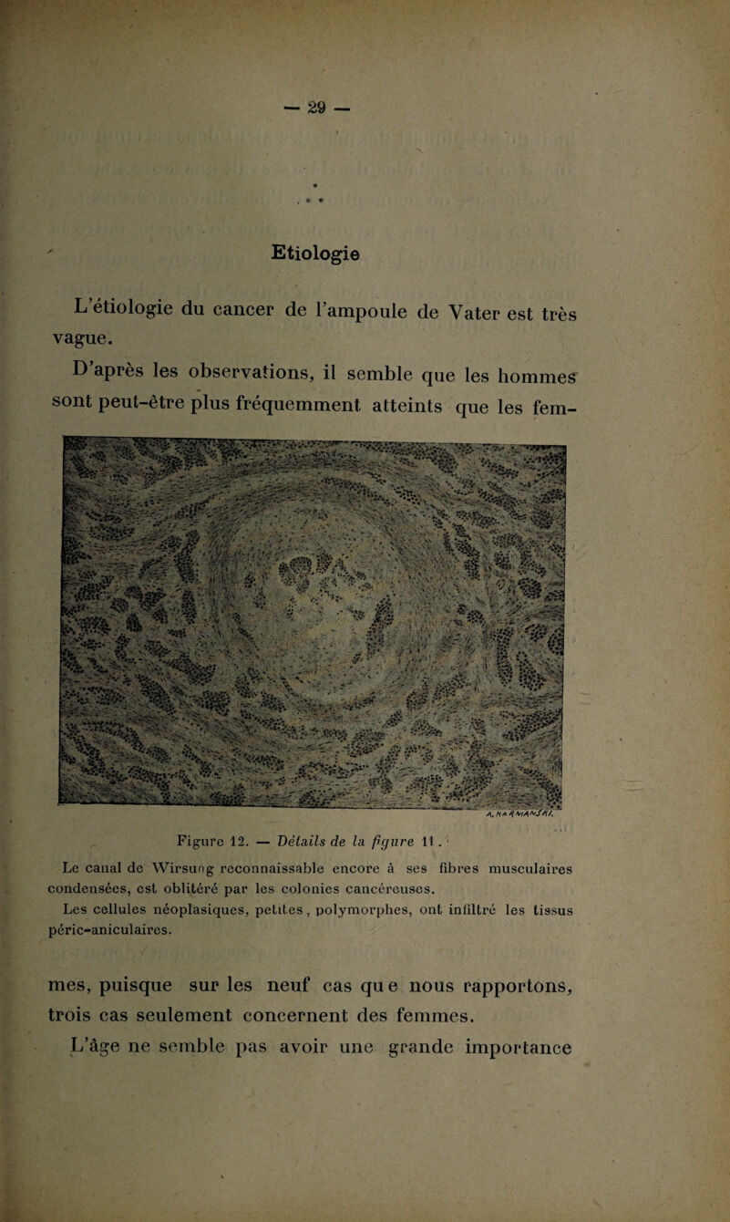 Etiologie A L’étiologie du cancer de l’ampoule de Yater est très vague. D apres les observations, il semble que les hommes sont peut-être plus fréquemment atteints que les fem- 4. Ha Figure 12. — Détails de la figure 11. ’ Le canal de Wirsung reconnaissable encore à ses fibres musculaires condensées, est oblitéré par les colonies cancéreuses. Les cellules néoplasiques, petites, polymorphes, ont infiltré les tissus péric-aniculaires. mes, puisque sur les neuf cas qu e nous rapportons, trois cas seulement concernent des femmes. L’âge ne semble pas avoir une grande importance