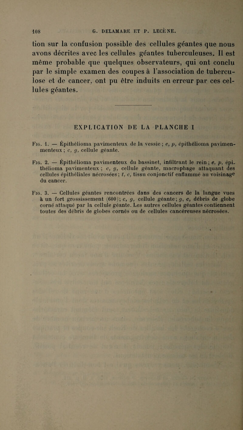 tion sur la confusion possible des cellules géantes que nous avons décrites avec les cellules géantes tuberculeuses. Il est même probable que quelques observateurs, qui ont conclu par le simple examen des coupes à l'association de tubercu¬ lose et de cancer, ont pu être induits en erreur par ces cel¬ lules géantes. EXPLICATION DE LA PLANCHE I Fig. 1. — Épithélioma pavimenteux de la vessie ; e, p, épithélioma pavimen- menteux ; c, g, cellule géante. Fig. 2. — Épithélioma pavimenteux du bassinet, infiltrant le rein ; e, p, épi¬ thélioma pavimenteux ; c, g, cellule géante, macrophage attaquant des cellules épithéliales nécrosées; t, c, tissu conjonctif enflammé au voisinage du cancer. Fig. 3. — Cellules géantes rencontrées dans des cancers de la langue vues à un fort grossissement (600); c, g, cellule géante; c, débris de globe corné attaqué par la cellule géante. Les autres cellules géantes contiennent toutes des débris de globes cornés ou de cellules cancéreuses nécrosées.