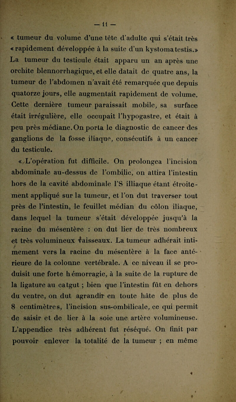 « tumeur du volume d’une tête d’adulte qui s’était très «rapidement développée à la suite d’un kystomatestis.» La tumeur du testicule était apparu un an après une orchite blennorrhagique, et elle datait de quatre ans, la tumeur de Fabdomen n’avait été remarquée que depuis quatorze jours, elle augmentait rapidement de volume. Cette dernière tumeur paraissait mobile, sa surface était irrégulière, elle occupait l’hypogastre, et était à peu près médiane.On porta le diagnostic de cancer des ganglions de la fosse iliaque, consécutifs à un cancer du testicule. « L’opération fut difficile. On prolongea l’incision abdominale au-dessus de l’ombilic, on attira l’intestin hors de la cavité abdominale l’S illiaque étant étroite¬ ment appliqué sur la tumeur, et l’on dut traverser tout près de Fintestin, le feuillet médian du côlon iliaque, dans lequel la tumeur s’était développée jusqu’à la racine du mésentère : on dut lier de très nombreux et très volumineux Vaisseaux. La tumeur adhérait inti- k mement vers la racine du mésentère à la face anté¬ rieure de la colonne vertébrale. A ce niveau il se pro¬ duisit une forte hémorragie, à la suite de la rupture de la ligature au catgut ; bien que Fintestin fût en dehors du ventre, on dut agrandir en toute hâte de plus de 8 centimètres, l’incision sus-ombilicale, ce qui permit de saisir et de lier à la soie une artère volumineuse. L’appendice très adhérent fut réséqué. On finit par » pouvoir enlever la totalité de la tumeur ; en même i \ i «