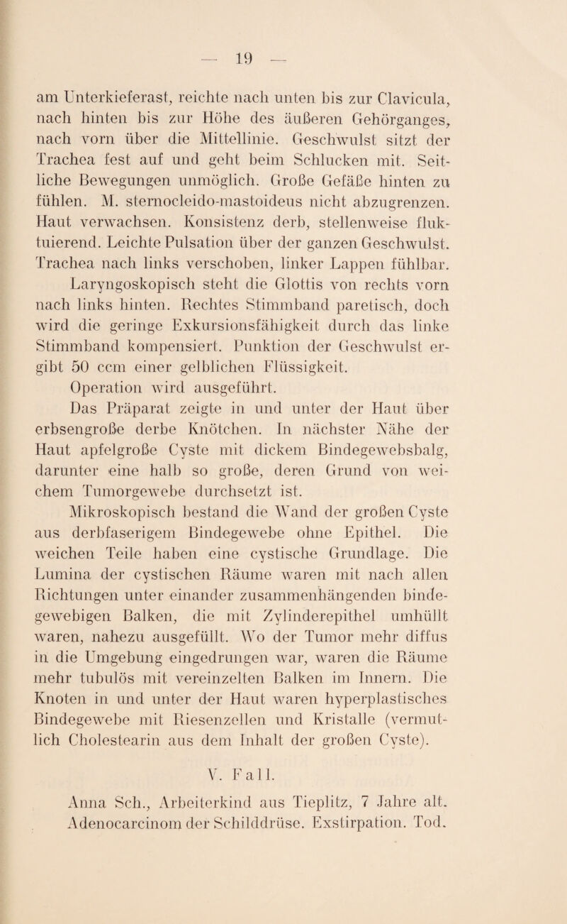 am Unterkieferast, reichte nach unten bis zur Clavicula, nach hinten bis zur Höhe des äußeren Gehörganges, nach vorn über die Mittellinie. Geschwulst sitzt der Trachea fest auf und geht beim Schlucken mit. Seit¬ liche Bewegungen unmöglich. Große Gefäße hinten zu fühlen. M. sternocleido-mastoideus nicht abzugrenzen. Haut verwachsen. Konsistenz derb, stellenweise fluk¬ tuierend. Leichte Pulsation über der ganzen Geschwulst. Trachea nach links verschoben, linker Lappen fühlbar. Laryngoskopisch steht die Glottis von rechts vorn nach links hinten. Rechtes Stimmband paretisch, doch wird die geringe Exkursionsfähigkeit durch das linke Stimmhand kompensiert. Punktion der Geschwulst er¬ gibt 50 ccm einer gelblichen Flüssigkeit. Operation wird ausgeführt. Das Präparat zeigte in und unter der Haut über erbsengroße derbe Knötchen. In nächster Nähe der Haut apfelgroße Cyste mit dickem Bindegewebsbalg, darunter eine halb so große, deren Grund von wei¬ chem Tumorgewebe durchsetzt ist. Mikroskopisch bestand die Wand der großen Cyste aus derbfaserigem Bindegewebe ohne Epithel. Die weichen Teile haben eine cystische Grundlage. Die Lumina der cystischen Räume waren mit nach allen Richtungen unter einander zusammenhängenden binde¬ gewebigen Balken, die mit Zylinderepithel umhüllt waren, nahezu ausgefüllt. Wo der Tumor mehr diffus in die Umgehung eingedrungen war, waren die Räume mehr tubulös mit vereinzelten Balken im Innern. Die Knoten in und unter der Haut waren hyperplastisches Bindegewebe mit Riesenzellen und Kristalle (vermut¬ lich Cholestearin aus dem Inhalt der großen Cyste). V. Fall. Anna Sch., Arbeiterkind aus Tieplitz, 7 Jahre alt. Adenocarcinom der Schilddrüse. Exstirpation. Tod.