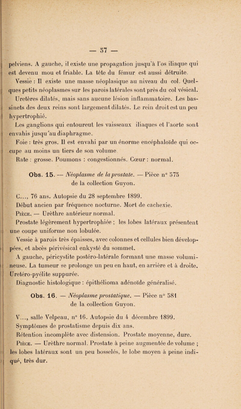 -^Ec pelviens. A gauche, il existe une propagation jusqu’à l’os iliaque qui est devenu mou et friable. La tête du fémur est aussi détruite. Vessie : Il existe une masse néoplasique au niveau du col. Quel¬ ques petits néoplasmes sur les parois latérales sont près du col vésical. Uretères dilatés, mais sans aucune lésion inflammatoire. Les bas¬ sinets des deux reins sont largement dilatés. Le rein droit est un peu hypertrophié. Les ganglions qui entoureut les vaisseaux iliaques et l’aorte sont envahis jusquàiu diaphragme. Foie : très gros. Il est envahi par un énorme encéphaloïde qui oc¬ cupe au moins un tiers de son volume Rate : grosse. Poumons : congestionnés. Cœur: normal. Obs. 15. — Néoplasme de laprostale. —Pièce n° 575 de la collection Guyon. G..., 76 ans. Autopsie du 28 septembre 1899. Début ancien par fréquence nocturne. Mort de cachexie. Pièce. — Urèthre antérieur normal. Prostate légèrement hypertrophiée ; les lobes latéraux présentent une coupe uniforme non lobulée. Vessie à parois très épaisses, avec colonnes et cellules bien dévelop¬ pées, et abcès périvésical enkysté du sommet. A gauche, péricystite postéro-latérale formant une masse volumi¬ neuse. La tumeur se prolonge un peu en haut, en arrière et à droite. Uretéro-pyélite suppurée. Diagnostic histologique : épithélioma adénoïde généralisé. Obs. 16. — Néoplasme prostatique. — Pièce n° 581 de la collection Guyon. V..., salle Velpeau, n° 16. Autopsie du 4 décembre 1899. Symptômes de prostatisme depuis dix ans. Rétention incomplète avec distension. Prostate moyenne, dure. Pièce. — Urèthre normal. Prostate à peine augmentée de volume ; les lobes latéraux sont un peu bosselés, le lobe moyen à peine indi- j qué, très dur.