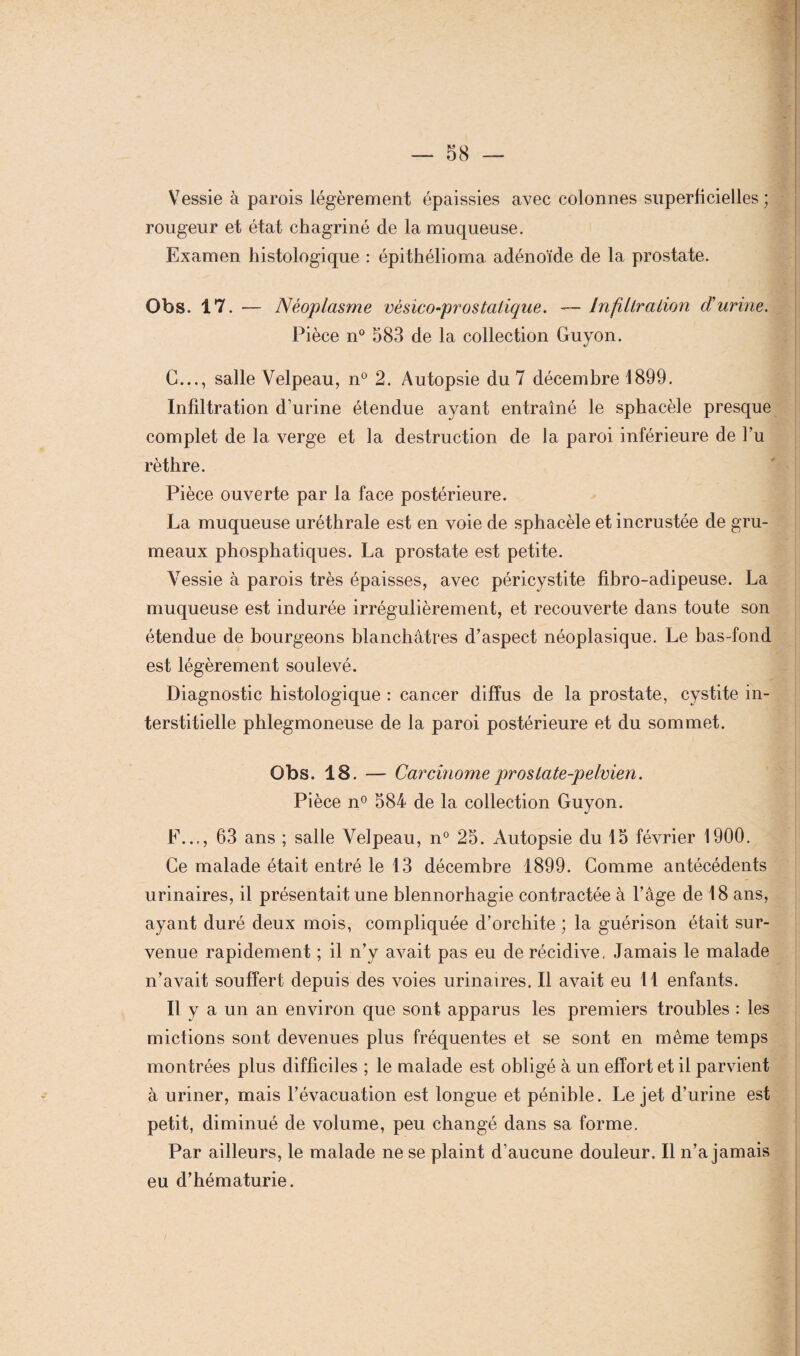 Vessie à parois légèrement épaissies avec colonnes superficielles; rougeur et état chagriné de la muqueuse. Examen histologique : épithélioma adénoïde de la prostate. Obs. 17. — Néoplasme vêsîco-prostatique. -— Infiltration d'urine. Pièce n° 583 de la collection Guyon. C..., salle Velpeau, n° 2. Autopsie du 7 décembre 1899. Infiltration d’urine étendue ayant entraîné le sphacèle presque complet de la verge et la destruction de la paroi inférieure de l’u rèthre. Pièce ouverte par la face postérieure. La muqueuse uréthrale est en voie de sphacèle et incrustée de gru¬ meaux phosphatiques. La prostate est petite. Vessie à parois très épaisses, avec péricystite fibro-adipeuse. La muqueuse est indurée irrégulièrement, et recouverte dans toute son étendue de bourgeons blanchâtres d’aspect néoplasique. Le bas-fond est légèrement soulevé. Diagnostic histologique : cancer diffus de la prostate, cystite in¬ terstitielle phlegmoneuse de la paroi postérieure et du sommet. Obs. 18. — Carcinome prostate-pelvien. Pièce n° 584 de la collection Guyon. F..., 63 ans ; salle Velpeau, n° 25. Autopsie du 15 février 1900. Ce malade était entré le 13 décembre 1899. Comme antécédents urinaires, il présentait une blennorhagie contractée à l’âge de 18 ans, ayant duré deux mois, compliquée d’orchite ; la guérison était sur¬ venue rapidement ; il n’y avait pas eu de récidive, Jamais le malade n’avait souffert depuis des voies urinaires. Il avait eu 11 enfants. Il y a un an environ que sont apparus les premiers troubles : les mictions sont devenues plus fréquentes et se sont en même temps montrées plus difficiles ; le malade est obligé à un effort et il parvient à uriner, mais l’évacuation est longue et pénible. Le jet d’urine est petit, diminué de volume, peu changé dans sa forme. Par ailleurs, le malade ne se plaint d’aucune douleur. Il n’a jamais eu d’hématurie.