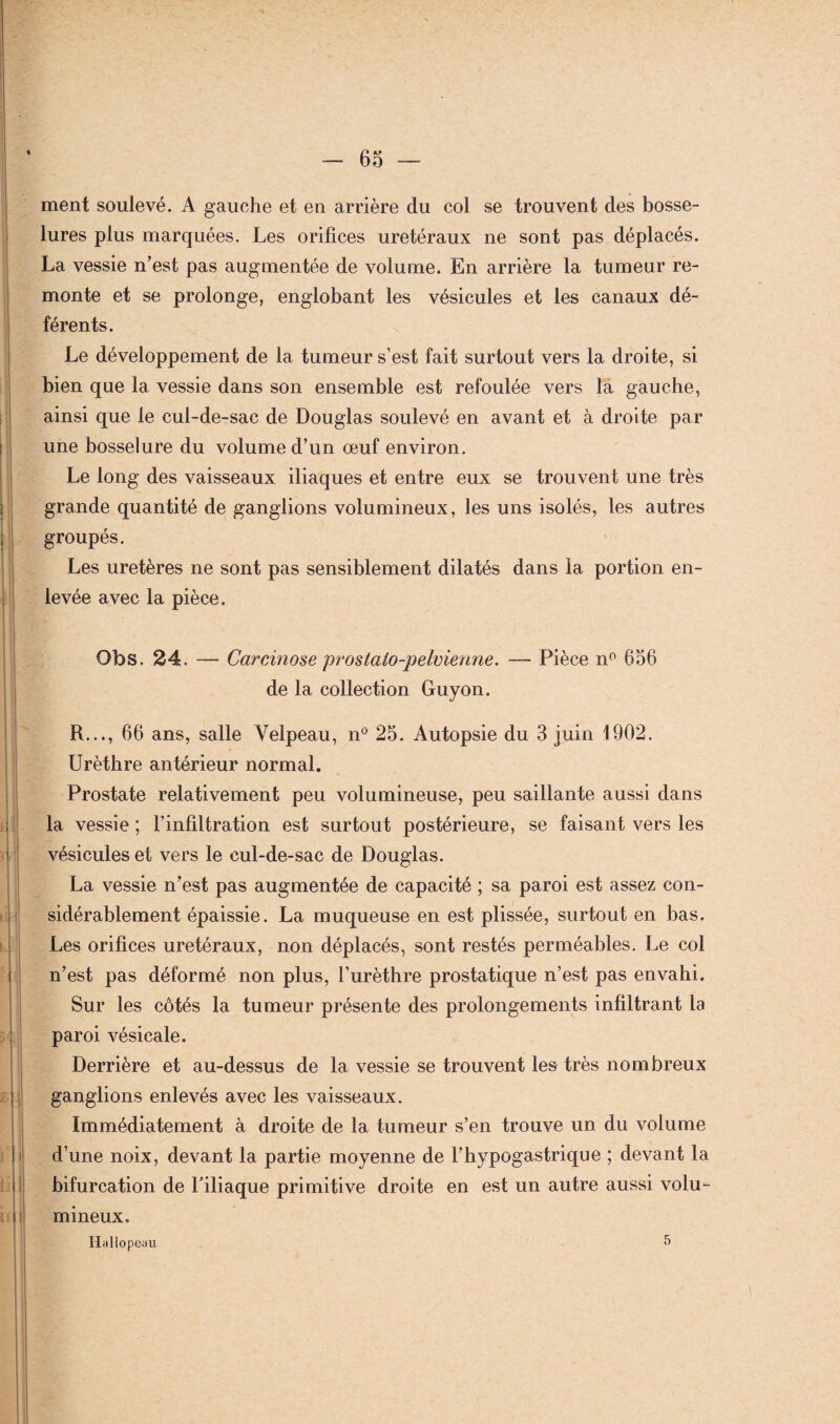 ment soulevé. A gauche et en arrière du col se trouvent des bosse¬ lures plus marquées. Les orifices urétéraux ne sont pas déplacés. La vessie n’est pas augmentée de volume. En arrière la tumeur re¬ monte et se prolonge, englobant les vésicules et les canaux dé¬ férents. Le développement de la tumeur s’est fait surtout vers la droite, si bien que la vessie dans son ensemble est refoulée vers la gauche, ainsi que le cul-de-sac de Douglas soulevé en avant et à droite par une bosselure du volume d’un œuf environ. Le long des vaisseaux iliaques et entre eux se trouvent une très grande quantité de ganglions volumineux, les uns isolés, les autres groupés. Les uretères ne sont pas sensiblement dilatés dans la portion en¬ levée avec la pièce. Obs. 24. — CarcÀnose prostalo-pelvienne. — Pièce n° 606 de la collection Guyon. R..., 66 ans, salle Velpeau, n° 25. Autopsie du 3 juin 1902. Urèthre antérieur normal. Prostate relativement peu volumineuse, peu saillante aussi dans la vessie ; l’infiltration est surtout postérieure, se faisant vers les vésicules et vers le cul-de-sac de Douglas. La vessie n’est pas augmentée de capacité ; sa paroi est assez con¬ sidérablement épaissie. La muqueuse en est plissée, surtout en bas. Les orifices urétéraux, non déplacés, sont restés perméables. Le col n’est pas déformé non plus, l’urèthre prostatique n’est pas envahi. Sur les côtés la tumeur présente des prolongements infiltrant la paroi vésicale. Derrière et au-dessus de la vessie se trouvent les très nombreux ganglions enlevés avec les vaisseaux. Immédiatement à droite de la tumeur s’en trouve un du volume d’une noix, devant la partie moyenne de l’hypogastrique ; devant la bifurcation de l’iliaque primitive droite en est un autre aussi volu¬ mineux, Hallopeau 5