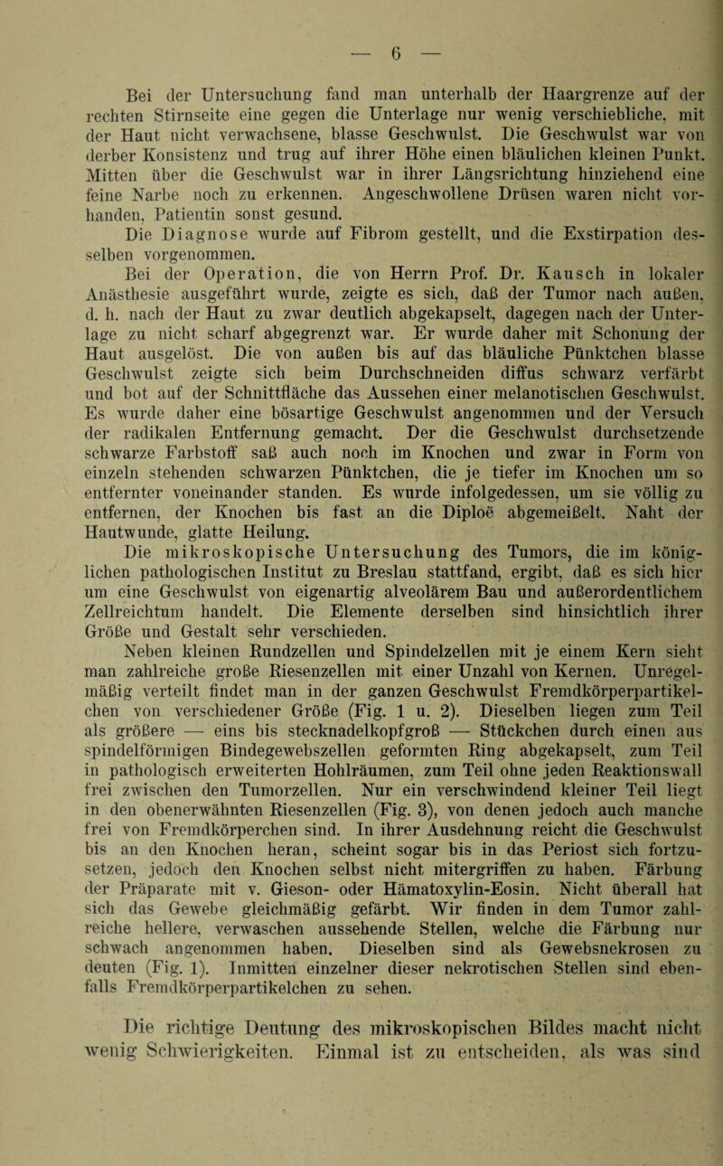 Bei der Untersuchung fand man unterhalb der Haargrenze auf der rechten Stirnseite eine gegen die Unterlage nur wenig verschiebliche, mit der Haut nicht verwachsene, blasse Geschwulst. Die Geschwulst war von derber Konsistenz und trug auf ihrer Höhe einen bläulichen kleinen Punkt. Mitten über die Geschwulst war in ihrer Längsrichtung hinziehend eine feine Narbe noch zu erkennen. Angeschwollene Drüsen waren nicht vor¬ handen, Patientin sonst gesund. Die Diagnose wurde auf Fibrom gestellt, und die Exstirpation des¬ selben vorgenommen. Bei der Operation, die von Herrn Prof. Dr. Kausch in lokaler Anästhesie ausgeführt wurde, zeigte es sich, daß der Tumor nach außen, d. h. nach der Haut zu zwar deutlich abgekapselt, dagegen nach der Unter¬ lage zu nicht scharf abgegrenzt wmr. Er wurde daher mit Schonung der Haut ausgelöst. Die von außen bis auf das bläuliche Pünktchen blasse Geschwulst zeigte sich beim Durchschneiden diffus schwarz verfärbt und bot auf der Schnittfläche das Aussehen einer melanotisclien Geschwulst. Es wurde daher eine bösartige Geschwulst angenommen und der Versuch der radikalen Entfernung gemacht. Der die Geschwulst durchsetzende schwarze Farbstoff saß auch noch im Knochen und zwar in Form von einzeln stehenden schwarzen Pünktchen, die je tiefer im Knochen um so entfernter voneinander standen. Es wurde infolgedessen, um sie völlig zu entfernen, der Knochen bis fast an die Diploe abgemeißelt. Naht der Hautwunde, glatte Heilung. Die mikroskopische Untersuchung des Tumors, die im könig¬ lichen pathologischen Institut zu Breslau stattfand, ergibt, daß es sich hier um eine Geschwulst von eigenartig alveolärem Bau und außerordentlichem Zellreichtum handelt. Die Elemente derselben sind hinsichtlich ihrer Größe und Gestalt sehr verschieden. Neben kleinen Bundzellen und Spindelzellen mit je einem Kern sieht man zahlreiche große Biesenzellen mit einer Unzahl von Kernen. Unregel¬ mäßig verteilt findet man in der ganzen Geschwulst Fremdkörperpartikel¬ ehen von verschiedener Größe (Fig. 1 u. 2). Dieselben liegen zum Teil als größere — eins bis stecknadelkopfgroß — Stückchen durch einen aus spindelförmigen Bindegewebszellen geformten Bing abgekapselt, zum Teil in pathologisch erweiterten Hohlräumen, zum Teil ohne jeden Beaktionswall frei zwischen den Tumorzellen. Nur ein verschwindend kleiner Teil liegt in den obenerwähnten Biesenzellen (Fig. 3), von denen jedoch auch manche frei von Fremdkörperchen sind. In ihrer Ausdehnung reicht die Geschwulst bis an den Knochen heran, scheint sogar bis in das Periost sich fortzu¬ setzen, jedoch den Knochen selbst nicht mitergriffen zu haben. Färbung der Präparate mit v. Gieson- oder Hämatoxylin-Eosin. Nicht überall hat sich das Gewebe gleichmäßig gefärbt. Wir finden in dem Tumor zahl¬ reiche hellere, verwaschen aussehende Stellen, welche die Färbung nur schwach angenommen haben. Dieselben sind als Gewebsnekrosen zu deuten (Fig. 1). Inmitten einzelner dieser nekrotischen Stellen sind eben¬ falls Fremdkörperpartikelchen zu sehen. Die richtige Deutung des mikroskopischen Bildes macht nicht wenig Schwierigkeiten. Einmal ist zu entscheiden, als was sind