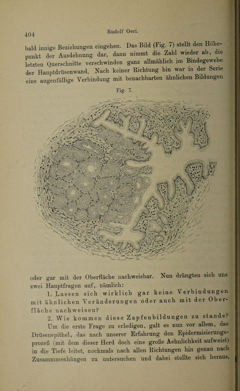 bald innige Beziehungen eingehen. Das Bild (Fig. 7) stellt den Höhe¬ punkt der Ausdehnung dar, dann nimmt die Zahl wieder ab, die letzten Querschnitte verschwinden ganz allmählich im Bindegewe e der Hauptdrüsenwand. Hach keiner Richtung hin war in der Serie eine augenfällige Verbindung mit benachbarten ähnlichen Bildungen Fig. 7. »V • i ).-\A/ h, \i y * - y; f>: Vf Vm. y<- fj oder gar mit der Oberfläche nachweisbar. Nun drängten sich uns zwei Hauptfragen auf, nämlich: 1. Lassen sich wirklich gar keine Verbindungen mit ähnlichen Veränderungen oder auch mit der Ober¬ fläche nach weisen? 2. Wie kommen diese Zapfenbildungen zu stände. Um die erste Frage zu erledigen, galt es nun vor allem, das Drüsenepithel, das nach unserer Erfahrung den Epidermisierungs- prozeß (mit dem dieser Herd doch eine große Aehnlichkeit aufweist) in die Tiefe leitet, nochmals nach allen Richtungen hin genau nach Zusammmenliängen zu untersuchen und dabei stellte sich hei aus,