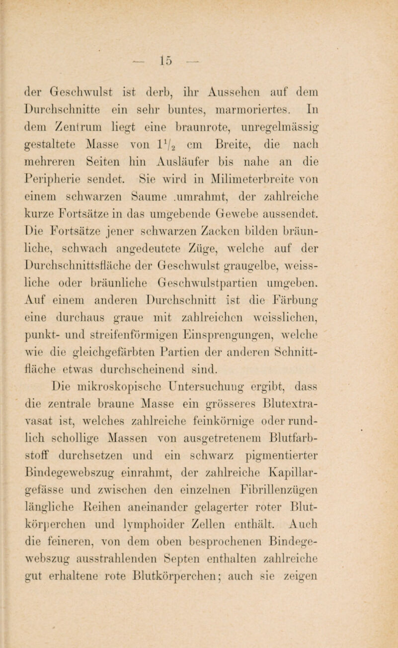 der Geschwulst ist derb, ihr Aussehen auf dem Durchschnitte ein sehr buntes, marmoriertes. In dem Zentrum liegt eine braunrote, unregelmässig gestaltete Masse von lxj2 cm Breite, die nach mehreren Seiten hin Ausläufer bis nahe an die Peripherie sendet. Sie wird in Milimeterbreite von einem schwarzen Saume .umrahmt, der zahlreiche kurze Fortsätze in das umgebende Gewebe aussendet. Die Fortsätze jener schwarzen Zacken bilden bräun¬ liche, schwach angedeutete Züge, welche auf der Durchschnittshäche der Geschwulst graugelbe, weiss¬ liehe oder bräunliche Geschwulstpartien umgeben. Auf einem anderen Durchschnitt ist die Färbung eine durchaus graue mit zahlreichen weisslichen, punkt- und streifenförmigen Einsprengungen, welche wie die gleichgefärbten Partien der anderen Schnitt¬ fläche etwas durchscheinend sind. Die mikroskopische Untersuchung ergibt, dass die zentrale braune Masse ein grösseres Blutextra¬ vasat ist, welches zahlreiche feinkörnige oder rund¬ lich schollige Massen von ausgetretenem Blutfarb¬ stoff durchsetzen und ein schwarz pigmentierter Bindegewebszug einrahmt, der zahlreiche Kapillar- gefässe und zwischen den einzelnen Fibrillenzügen längliche Reihen aneinander gelagerter roter Blut¬ körperchen und lymphoider Zellen enthält. Auch die feineren, von dem oben besprochenen Bindege¬ webszug ausstrahlenden Septen enthalten zahlreiche gut erhaltene rote Blutkörperchen; auch sie zeigen