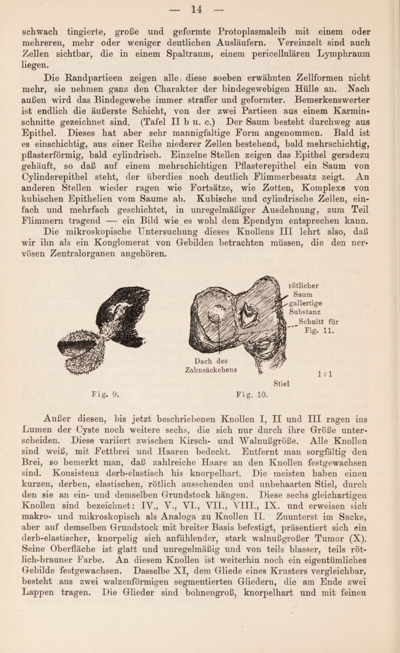 schwach fingierte, große und geformte Protoplasmaleib mit einem oder mehreren, mehr oder weniger deutlichen Ausläufern. Vereinzelt sind auch Zellen sichtbar, die in einem Spaltraum, einem pericellulären Lymphraum liegen. Die Randpartieen zeigen alle diese soeben erwähnten Zellformen nicht mehr, sie nehmen ganz den Charakter der bindegewebigen Hülle an. Nach außen wird das Bindegewebe immer straffer und geformter. Bemerkenswerter ist endlich die äußerste Schicht, von der zwei Partieen aus einem Karmin¬ schnitte gezeichnet sind. (Tafel II b u. c.) Der Saum besteht durchweg aus Epithel. Dieses hat aber sehr mannigfaltige Form angenommen. Bald ist es einschichtig, aus einer Reihe niederer Zellen bestehend, bald mehrschichtig, pflasterförmig, bald cylindrisch. Einzelne Stellen zeigen das Epithel geradezu gehäuft, so daß auf einem mehrschichtigen Pflasterepithel ein Saum von Cylinderepithel steht, der überdies noch deutlich Elimmerbesatz zeigt. An anderen Stellen wieder ragen wie Fortsätze, wie Zotten, Komplexe von kubischen Epithelien vom Saume ab. Kubische und cylindrische Zellen, ein¬ fach und mehrfach geschichtet, in unregelmäßiger Ausdehnung, zum Teil Flimmern tragend — ein Bild wie es wohl dem Ependym entsprechen kann. Die mikroskopische Untersuchung dieses Knollens III lehrt also, daß wir ihn als ein Konglomerat von Gebilden betrachten müssen, die den ner¬ vösen Zentralorganen angehören. Fig. 9. rötlicher Saum gallertige Substanz Schnitt für Fig. 11. Dach des Zahnsäckchens Stiel Fig. 10. Außer diesen, bis jetzt beschriebenen Knollen I, II und III ragen ins Lumen der Cyste noch weitere sechs, die sich nur durch ihre Größe unter¬ scheiden. Diese variiert zwischen Kirsch- und Walnußgroße. Alle Knollen sind weiß, mit Fettbrei und Haaren bedeckt. Entfernt man sorgfältig den Brei, so bemerkt man, daß zahlreiche Haare an den Knollen festgewachsen sind. Konsistenz derb-elastisch his knorpelhart. Die meisten haben einen kurzen, derben, elastischen, rötlich aussehenden und unbehaarten Stiel, durch den sie an ein- und demselben Grundstock hängen. Diese sechs gleichartigen Knollen sind bezeichnet: IV., V., VI., VII., VIII., IX. und erweisen sich makro- und mikroskopisch als Analoga zu Knollen II. Zuunterst im Sacke, aber auf demselben Grundstock mit breiter Basis befestigt, präsentiert sich ein derb-elastischer, knorpelig sich anfühlender, stark walnußgroßer Tumor (X). Seine Oberfläche ist glatt und unregelmäßig und von teils blasser, teils röt¬ lich-brauner Farbe. An diesem Knollen ist weiterhin noch ein eigentümliches Gebilde festgewachsen. Dasselbe XI, dem Gliede eines Krusters vergleichbar, besteht aus zwei walzenförmigen segmentierten Gliedern, die am Ende zwei Lappen tragen. Die Glieder sind bohnengroß, knorpelhart und mit feinen