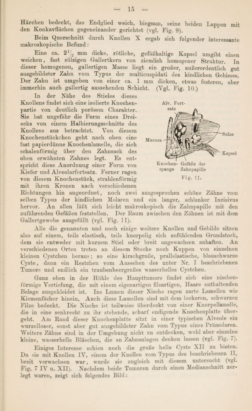 Härchen bedeckt, das Endglied weich, biegsam, seine beiden Lappen mit den Konkavflächen gegeneinander gerichtet (vgl. Fig. 9). Beim Querschnitt durch Knollen X ergab sich folgender interessante makroskopische Befund: Eine ca. 2 ^ mm dicke, rötliche, gefäßhaltige Ivapsel umgibt einen weichen, fast sülzigen Gallertkern von ziemlich homogener Struktur. In dieser homogenen, gallertigen Masse liegt ein großer, außerordentlich gut ausgebildeter Zahn vom Typus der multicuspidati des kindlichen Gebisses. Der Zahn ist umgeben von einer ca. 1 mm dicken, etwas festeren, aber immerhin auch gallertig aussehenden Schicht. (Vgl. Fig. 10.) In der Nähe des Stieles dieses Knollens findet sich eine isolierte Knochen¬ partie von deutlich porösem Charakter. Sie hat ungefähr die Form eines Drei¬ ecks von einem Halbierungsschnitte des Knollens aus betrachtet. Von diesem Knochenstückchen geht nach oben eine fast papierdünne Knochenlamelle, die sich schalenförmig über den Zahnsack des oben erwähnten Zahnes legt. Es ent¬ spricht diese Anordnung einer Form von Kiefer und Alveolarfortsatz. Ferner ragen von diesem Knochenstück, strahlenförmig 1-1 £• G. mit ihren Kronen nach verschiedenen Bichtungen hin angeordnet, noch zwei ausgesprochen schöne Zähne vom selben Typus der kindlichen Molaren und ein langer, schlanker Incisivus hervor. An allen läßt sich leicht makroskopisch die Zahnpapille mit den zuführenden Gefäßen feststellen. Der Baum zwischen den Zähnen ist mit dem Gallertgewebe ausgefüllt (vgl. Fig. 11). Alle die genannten und noch einige weitere Knollen und Gebilde sitzen also auf einem, teils elastisch, teils knorpelig sich anfühlenden Grundstock, dem sie entweder mit kurzem Stiel oder breit angewachsen anhaften. An verschiedenen Orten treten an diesem Stocke noch Kuppen von einzelnen kleinen Cystchen heraus; so eine kirschgroße, prallelastische, blauschwarze Cyste, dann ein Bestehen vom Aussehen des unter Nr. I beschriebenen Tumors und endlich ein traubenbeergroßes wasserhelles Cystchen. Ganz oben in der Höhle des Haupttumors findet sich eine nischen¬ förmige Vertiefung, die mit einem eigenartigen filzartigen, Haare enthaltenden Belage ausgekleidet ist. Ins Lumen dieser Nische ragen zarte Lamellen wie Kiemenfächer hinein. Auch diese Lamellen sind mit dem lockeren, schwarzen Filze bedeckt. Die Nische ist teilweise überdeckt von einer Knorpellamelle, die in eine senkrecht zu ihr stehende, scharf endigende Knochenplatte über¬ geht. Am Band dieser Knochenplatte sitzt in einer typischen Alveole ein wurzelloser, sonst aber gut ausgebildeter Zahn vom Typus eines Prämolaren. Weitere Zähne sind in der Umgebung nicht zu entdecken, wohl aber einzelne kleine, wasserhelle Bläschen, die an Zahnanlagen denken lassen (vgl. big. /). Einiges Interesse schien noch die große helle Cyste XII zu bieten. Da sie mit Knollen IV, einem der Knollen vom Typus des beschriebenen II, breit verwachsen war, wurde sie zugleich mit diesem untersucht (vgl. Fig. 7 IV u. XII). Nachdem beide Tumoren durch einen Medianschnitt zer¬ legt waren, zeigt sich folgendes Bild: Alv. Fort¬ satz Kapsel Knochen- Gefäße der spange Zahnpapille Mucosa Sülze