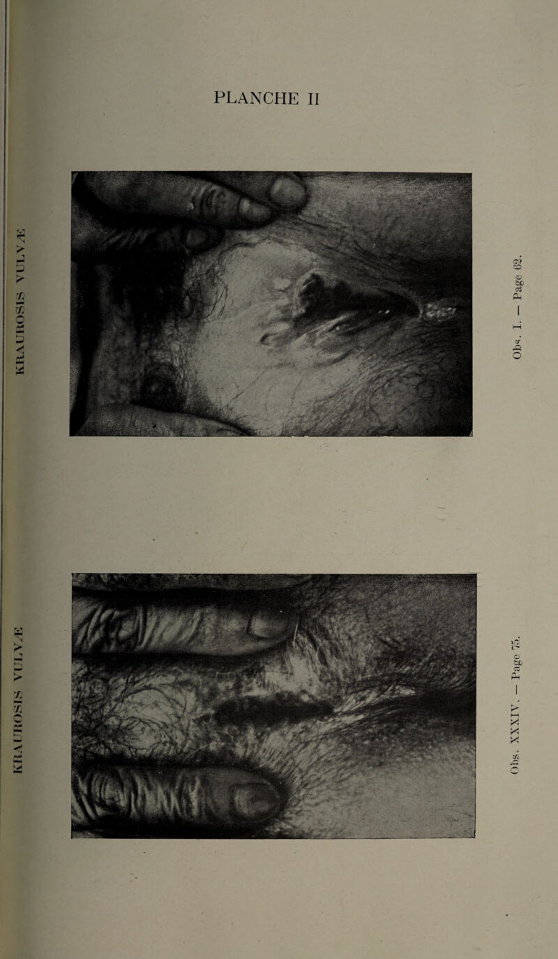 KHAUROSIS VULYÆ KRAUROSIS YULVÆ PLANCHE II Page 75. Ob^. I. — Page 62.