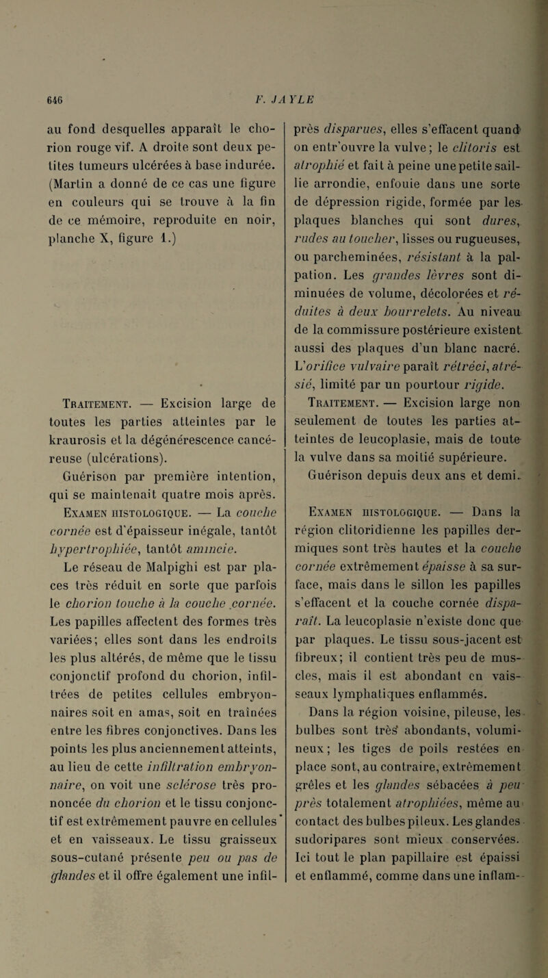 au fond desquelles apparaît le cho- rion rouge vif. A droite sont deux pe¬ tites tumeurs ulcérées à base indurée. (Martin a donné de ce cas une figure en couleurs qui se trouve à la fin de ce mémoire, reproduite en noir, planche X, figure 1.) Traitement. — Excision large de toutes les parties atteintes par le kraurosis et la dégénérescence cancé¬ reuse (ulcérations). Guérison par première intention, qui se maintenait quatre mois après. Examen histologique. — La couche cornée est d'épaisseur inégale, tantôt hypertrophiée, tantôt amincie. Le réseau de Malpighi est par pla¬ ces très réduit en sorte que parfois le cliorion touche à la couche cornée. Les papilles affectent des formes très variées; elles sont dans les endroits les plus altérés, de même que le tissu conjonctif profond du chorion, infil¬ trées de petites cellules embryon¬ naires soit en amas, soit en traînées entre les fibres conjonctives. Dans les points les plus anciennement atteints, au lieu de cette infiltration embryon¬ naire, on voit une sclérose très pro¬ noncée du chorion et le tissu conjonc¬ tif est extrêmement pauvre en cellules* et en vaisseaux. Le tissu graisseux sous-cutané présente peu ou pas de çflandes et il offre également une infil- près disparues, elles s’effacent quand' on entr’ouvre la vulve ; le clitoris est atrophié et fait à peine une petite sail¬ lie arrondie, enfouie dans une sorte de dépression rigide, formée par les. plaques blanches qui sont dures, rudes au toucher, lisses ou rugueuses, ou parcheminées, résistant à la pal¬ pation. Les grandes lèvres sont di¬ minuées de volume, décolorées et ré¬ duites à deux bourrelets. Au niveau de la commissure postérieure existent aussi des plaques d’un blanc nacré. L'orifice vulvaire paraît rétréci, atré- sié, limité par un pourtour rigide. Traitement. — Excision large non seulement de toutes les parties at¬ teintes de leucoplasie, mais de toute la vulve dans sa moitié supérieure. Guérison depuis deux ans et demi.. Examen histologique. — Dans la région clitoridienne les papilles der¬ miques sont très hautes et la couche cornée extrêmement épaisse à sa sur¬ face, mais dans le sillon les papilles s’effacent et la couche cornée dispa¬ raît. La leucoplasie n’existe donc que par plaques. Le tissu sous-jacent est fibreux; il contient très peu de mus¬ cles, mais il est abondant en vais¬ seaux lymphatiques enflammés. Dans la région voisine, pileuse, les bulbes sont très’ abondants, volumi¬ neux; les tiges de poils restées en place sont, au contraire, extrêmement grêles et les glandes sébacées à peu près totalement atrophiées, même au contact des bulbes pileux. Les glandes sudoripares sont mieux conservées. Ici tout le plan papillaire est épaissi et enflammé, comme dans une inflam-