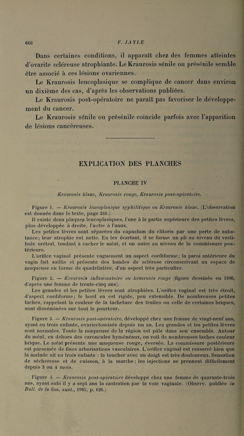 Dans certaines conditions, il apparaît chez des femmes atteintes d’ovarite scléreuse atrophiante. LeKraurosis sénile ou présénile semble être associé à ces lésions ovariennes. Le Kraurosis leucoplasique se complique de cancer dans environ un dixième des cas, d’après les observations publiées. Le Kraurosis post-opératoire ne paraît pas favoriser le développe¬ ment du cancer. Le Kraurosis sénile ou présénile coïncide parfois avec l’apparition de lésions cancéreuses. EXPLICATION DES PLANCHES PLANCHE IV Kraurosis blanc, Kraurosis rouge, Kraurosis post-opératoire. Figure 1. — Kraurosis leucoplasique syphilitique ou Kraurosis blanc. (L’observation est donnée dans le texte, page 248.) Il existe deux plaqueg leucoplasiques, l’une à la partie supérieure des petites lèvres, plus développée à droite, l’autre à l’anus. Les petites lèvres sont séparées du capuchon du clitoris par une perte de subs¬ tance; leur atrophie est nette. En les écartant, il se forme un pli au niveau du vesti¬ bule urétral, tendant à cacher le méat, et un autre au niveau de la commissure pos¬ térieure. L’orifice vaginal présente vaguement un aspect cordiforme; la paroi antérieure du vagin fait saillie et présente des bandes de sclérose circonscrivant un espace de muqueuse en forme de quadrilatère, d’un aspect très particulier. Figure 2. — Kraurosis inflammatoire ou kraurosis rouge (figure dessinée en 1896, d’après une femme de trente-cinq ans). Les grandes et les petites lèvres sont atrophiées. L’orifice vaginal est très étroit, d’aspect cordiforme; le bord en est rigide, peu extensible. De nombreuses petites taches, rappelant la couleur de la tacheture des truites ou celle de certaines briques, sont disséminées sur tout le pourtour. Figure 3. — Kraurosis post-opératoire, développé chez une femme de vingt-neuf ans, ayant eu trois enfants, ovariectomisée depuis un an. Les grandes et les petites lèvres sont normales. Toute la muqueuse de la région est pâle dans son ensemble. Autour du méat, en dehors des caroncules hyménéaux, on voit de nombreuses taches couleur brique. Le méat présente une muqueuse rouge, éversée. La commissure postérieure est parsemée de fines arborisations vasculaires. L’orifice vaginal est resserré bien que la malade ait eu trois enfants : la toucher avec un doigt est très douloureux. Sensation de sécheresse et de cuisson, à la marche ; les injections se prennent difficilement depuis 3 ou 4 mois. Figure 4. — Kraurosis post-opératoire développé chez une femme de quarante-trois ans, ayant subi il y a sept ans la castration par la voie vaginale. (Observ. publiée in Bull, de la Soc. anat., 1905, p. 626.)