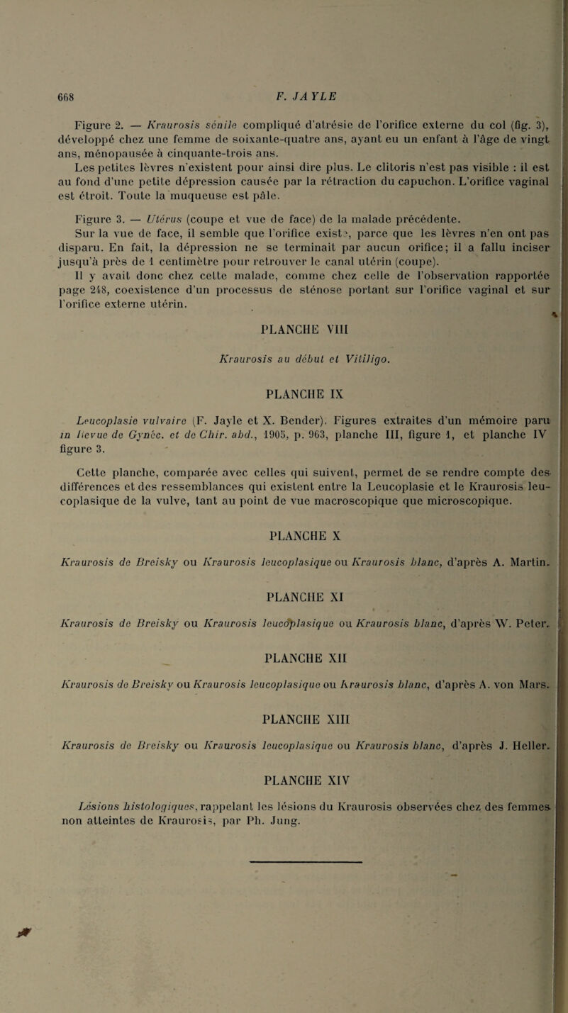 Figure 2. — Kraurosis scnile compliqué d’alrésie de l’orifice externe du col (fig. 3)r développé chez une femme de soixante-quatre ans, ayant eu un enfant à l’âge de vingt ans, ménopausée à cinquante-trois ans. Les petites lèvres n’existent pour ainsi dire plus. Le clitoris n’est pas visible : il est au fond d’une petite dépression causée par la rétraction du capuchon. L’orifice vaginal est étroit. Toute la muqueuse est pâle. Figure 3. — Utérus (coupe et vue de face) de la malade précédente. Sur la vue de face, il semble que l’orifice exista, parce que les lèvres n’en ont pas disparu. En fait, la dépression ne se terminait par aucun orifice; il a fallu inciser jusqu’à près de 1 centimètre pour retrouver le canal utérin (coupe). Il y avait donc chez cette malade, comme chez celle de l’observation rapportée page 248, coexistence d’un processus de sténose portant sur l’orifice vaginal et sur l’orifice externe utérin. PLANCHE VIII Kraurosis au début et Vililigo. PLANCHE IX Loucoplasic vulvaire (F. Jayle et X. Bender), Figures extraites d’un mémoire paru in lievue de Gynéc. et de Chir. abd., 1905, p. 963, planche III, figure 1, et planche IV figure 3. Cette planche, comparée avec celles qui suivent, permet de se rendre compte des¬ différences et des ressemblances qui existent entre la Leucoplasie et le Kraurosis leu- coplasique de la vulve, tant au point de vue macroscopique que microscopique. PLANCHE X Kraurosis de Breisky ou Kraurosis leucoplasique ou Kraurosis blanc, d’après A. Martin, PLANCHE XI Kraurosis de Breisky ou Kraurosis leucoplasique ou Kraurosis blanc, d’après W. Peter, PLANCHE XII Kraurosis de Breisky ou Kraurosis leucoplasique ou kraurosis blanc, d’après A. von Mars. PLANCHE XIII Kraurosis de Breisky ou Kraurosis leucoplasique ou Kraurosis blanc, d’après J. Heller, PLANCHE XIV Lésions histologiques, rappelant les lésions du Kraurosis observées chez des femmes- non atteintes de Kraurosis, par Pli. Jung.