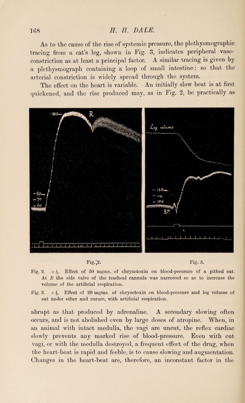 As to the cause of the rise of systemic pressure, the plethysmographic tracing from a cat’s leg, shown in Fig. 3, indicates peripheral vaso¬ constriction as at least a principal factor. A similar tracing is given by a plethysmograph containing a loop of small intestine: so that the arterial constriction is widely spread through the system. The effect on the heart is variable. An initially slow beat is at first quickened, and the rise produced may, as in Fig. 2, be practically as Fig.'k2. Fig. 3. Fig. 2. x J. Effect of 50 mgms. of chrysotoxin on blood-pressure of a pithed cat. At B the side valve of the tracheal cannula was narrowed so as to increase the volume of the artificial respiration. Fig. 3. x J. Effect of 20 mgms. of chrysotoxin on blood-pressure and leg volume of cat under ether and curare, with artificial respiration. abrupt as that produced by adrenaline. A secondary slowing often occurs, and is not abolished even by large doses of atropine. When, in an animal with intact medulla, the vagi are uncut, the reflex cardiac slowly prevents any marked rise of blood-pressure. Even with cut vagi, or with the medulla destroyed, a frequent effect of the drug, when the heart-beat is rapid and feeble, is to cause slowing and augmentation. Changes in the heart-beat are, therefore, an inconstant factor in the