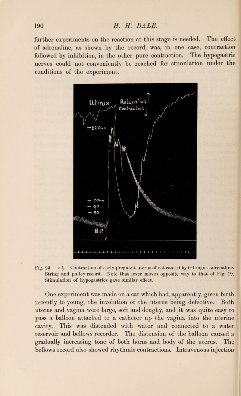 further experiments on the reaction at this stage is needed. The effect of adrenaline, as shown by the record, was, in one case, contraction followed by inhibition, in the other pure contraction. The hypogastric nerves could not conveniently be reached for stimulation under the conditions of the experiment. Fig. 20. x Contraction of early-pregnant uterus of cat caused by 0 1 mgm. adrenaline. String and pulley record. Note that lever moves opposite way to that of Fig. 19. Stimulation of hypogastrics gave similar effect. One experiment was made on a cat which had, apparently, given birth recently to young, the involution of the uterus being defective. Both uterus and vagina were large, soft and doughy, and it was quite easy to pass a balloon attached to a catheter up the vagina into the uterine cavity. This was distended with water and connected to a water reservoir and bellows recorder. The distension of the balloon caused a gradually increasing tone of both horns and body of the uterus. The bellows record also showed rhythmic contractions. Intravenous injection