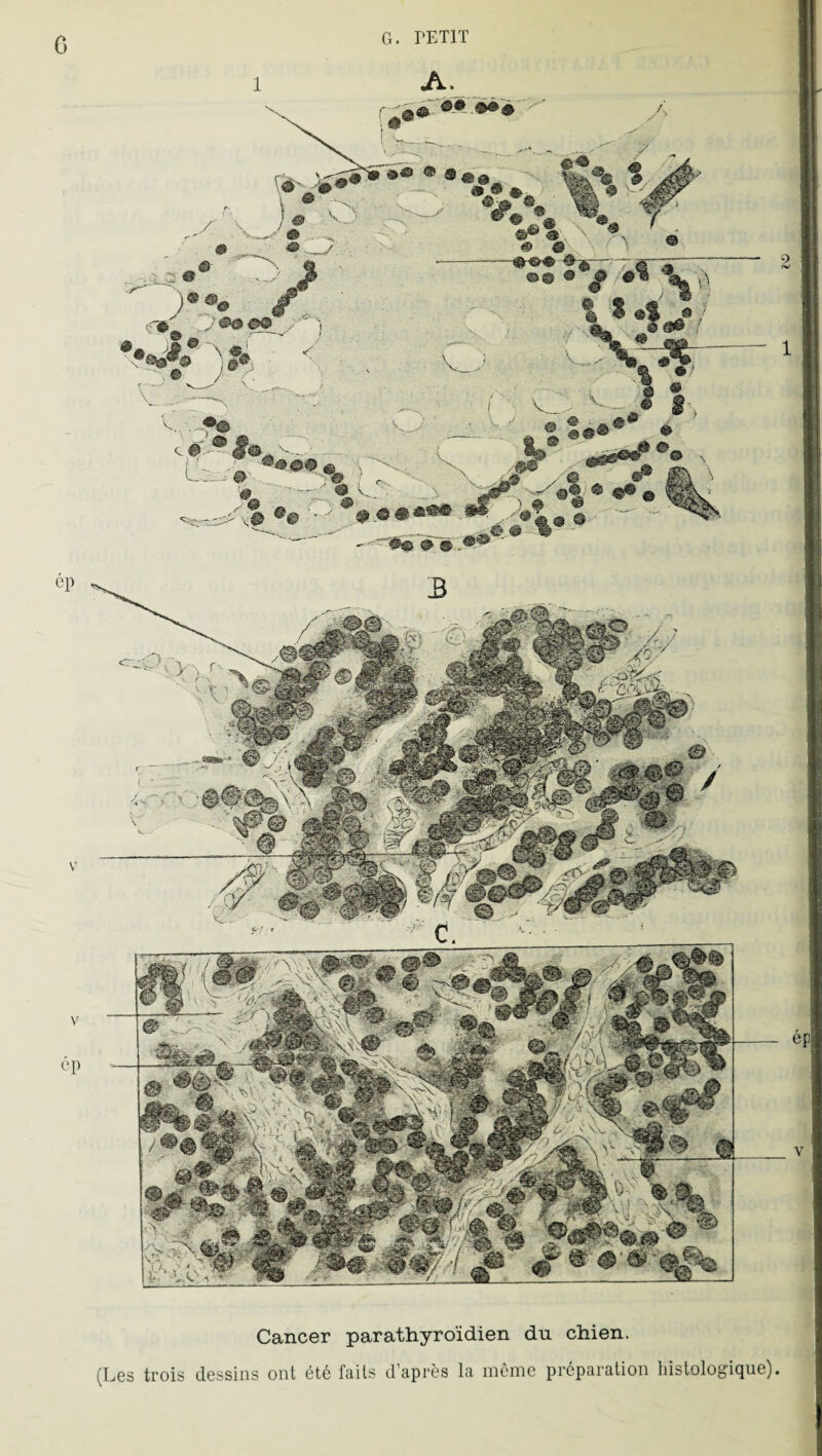 G ép V ép Cancer parathyroïdien du chien. (Les trois dessins ont été faits d’après la inenie préparation histologique)
