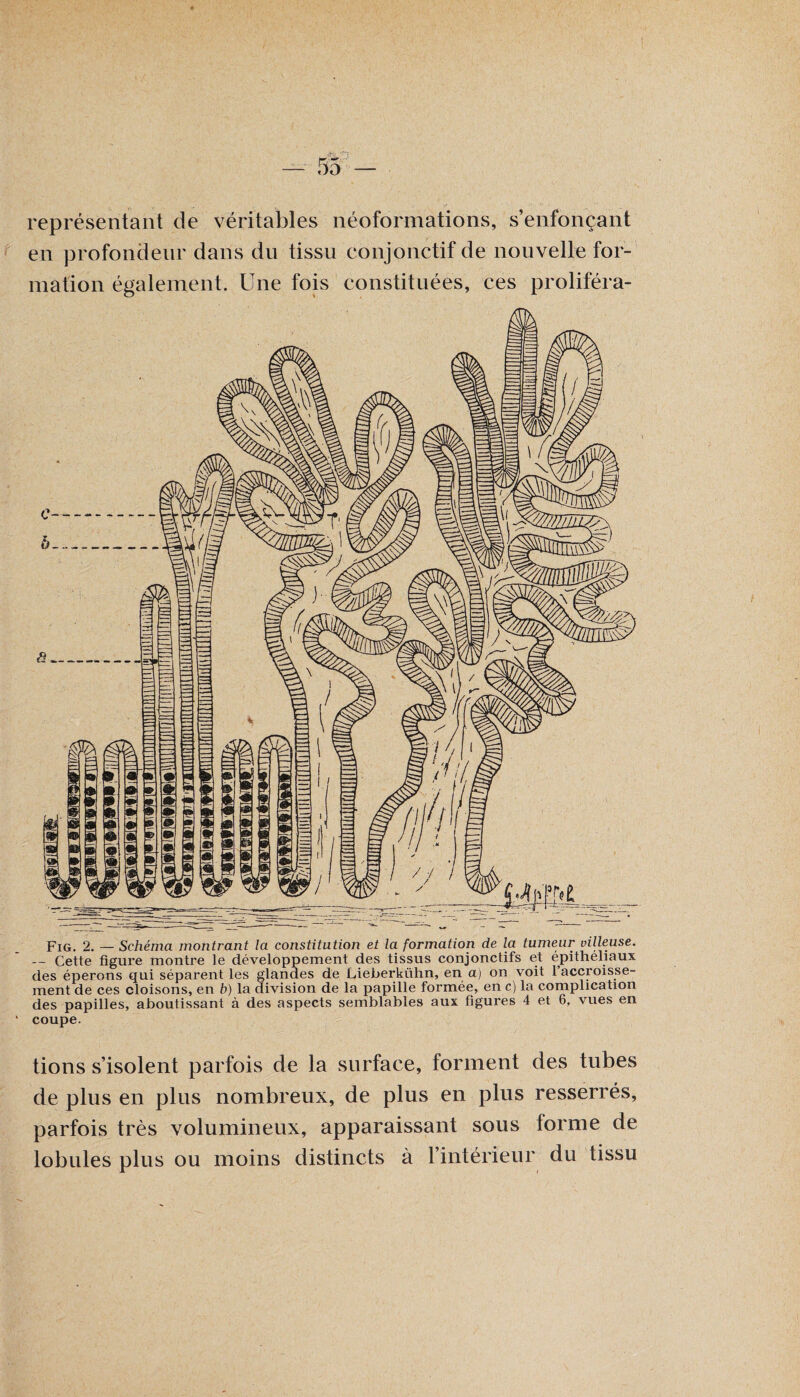 représentant de véritables néoformations, s’enfonçant en profondeur dans du tissu conjonctif de nouvelle for¬ mation également. Une fois constituées, ces proliféra- Fig. 2. — Schéma montrant la constitution et la formation de la tumeur villeuse. — Cette figure montre le développement des tissus conjonctifs et épithéliaux des éperons qui séparent les glandes de Lieberkühn, en a) on voit 1 accroisse¬ ment de ces cloisons, en b) la division de la papille formée, en c) la complication des papilles, aboutissant à des aspects semblables aux figures 4 et 6, vues en coupe. tions s’isolent parfois de la surface, forment des tubes de plus en plus nombreux, de plus en plus resserrés, parfois très volumineux, apparaissant sous forme de lobules plus ou moins distincts à l’intérieur du tissu