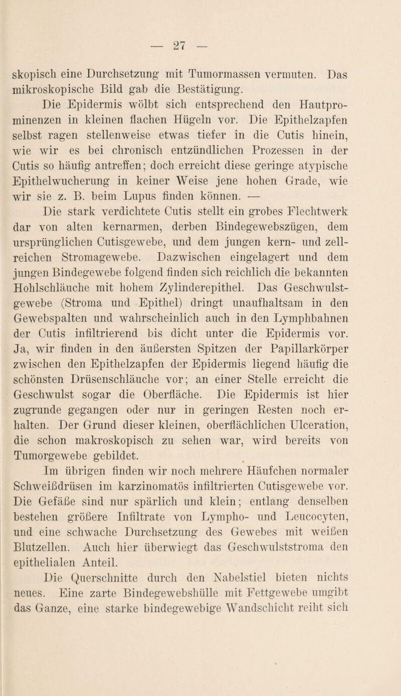 skopisch eine Durchsetzung mit Tumormassen vermuten. Das mikroskopische Bild gab die Bestätigung. Die Epidermis wölbt sich entsprechend den Hautpro¬ minenzen in kleinen flachen Hügeln vor. Die Epithelzapfen selbst ragen stellenweise etwas tiefer in die Cutis hinein, wie wir es bei chronisch entzündlichen Prozessen in der Cutis so häufig antreffen; doch erreicht diese geringe atypische Epithelwucherung in keiner Weise jene hohen Grade, wie wir sie z. B. beim Lupus finden können. — Die stark verdichtete Cutis stellt ein grobes Flechtwerk dar von alten kernarmen, derben Bindegewebszügen, dem ursprünglichen Cutisgewebe, und dem jungen kern- und zell¬ reichen Stromagewebe. Dazwischen eingelagert und dem jungen Bindegewebe folgend finden sich reichlich die bekannten Hohlschläuche mit hohem Zylinderepithel. Das Geschwulst¬ gewebe (Stroma und Epithel) dringt unaufhaltsam in den Gewebspalten und wahrscheinlich auch in den Lymphbahnen der Cutis infiltrierend bis dicht unter die Epidermis vor. Ja, wir finden in den äußersten Spitzen der Papillarkörper zwischen den Epithelzapfen der Epidermis liegend häufig die schönsten Drüsenschläuche vor; an einer Stelle erreicht die Geschwulst sogar die Oberfläche. Die Epidermis ist hier zugrunde gegangen oder nur in geringen Resten noch er¬ halten. Der Grund dieser kleinen, oberflächlichen Ulceration, die schon makroskopisch zu sehen war, wird bereits von Tumorgewebe gebildet. Im übrigen finden wir noch mehrere Häufchen normaler Schweißdrüsen im karzinomatös infiltrierten Cutisgewebe vor. Die Gefäße sind nur spärlich und klein; entlang denselben bestehen größere Infiltrate von Lympho- und Leucocyten, und eine schwache Durchsetzung des Gewebes mit weißen Blutzellen. Auch hier überwiegt das Geschwulststroma den epithelialen Anteil. Die Querschnitte durch den Nabelstiel bieten nichts neues. Eine zarte Bindegewebshülle mit Fettgewebe umgibt das Ganze, eine starke bindegewebige Wandschicht reiht sich