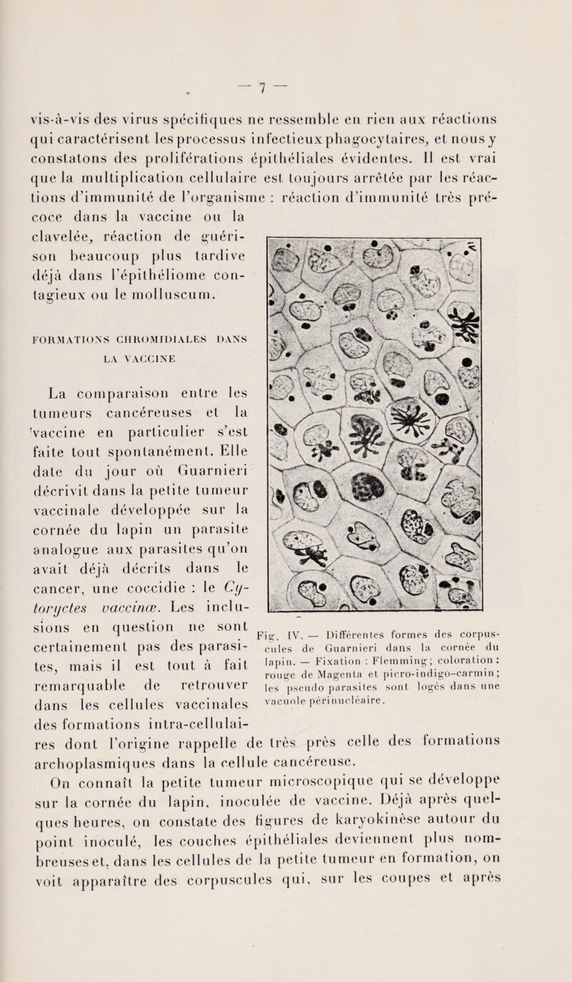 « vis-à-vis des virus spécifiques ne ressemble en rien aux réactions qui caractérisent les processus infectieux phagocytaires, et nous y constatons des proliférations épithéliales évidentes. Il est vrai que la multiplication cellulaire est tou jours arrêtée par les réac¬ tions d’immunité de l’organisme : réaction d’immunité très pré¬ coce dans la vaccine ou la clavelée, réaction de guéri¬ son beaucoup plus tardive déjà dans l’épithéliome con¬ tagieux ou le molluscum. FORMATIONS CHROMIDIALES DANS LA VACCINE La comparaison entre les tumeurs cancéreuses et la Vaccine en particulier s’est faite tout spontanément. Elle date du jour où Guarnieri décrivit dans la petite tumeur vaccinale développée sur la cornée du lapin un parasite analogue aux parasites qu’on avait déjà décrits dans le cancer, une coecidie : le Cy- toryctes uaccinœ. Les inclu¬ sions en question ne sont tit 4 1 . Fig-. IV. — Differentes formes des corpus- certainement pas des parasi- cules de Guarnieri dans la cornée du tes, mais il est tout à fait lopin. - Fixation : Nemming; coloration : rouge de Magenta et picro-indigo-carmin, remarquable de retrouver les pseudo parasites sont loges dans une dans les cellules vaccinales vacuole pennucleaire. des formations intra-cellulai¬ res dont l’origine rappelle de très près celle des formations archoplasmiques dans la cellule cancéreuse. On connaît la petite tumeur microscopique qui se développe sur la cornée du lapin, inoculée de vaccine. Déjà après quel¬ ques heures, on constate des figures de karyokinèse autour du point inoculé, les couches épithéliales deviennent plus nom¬ breuses et. dans les cellules de la petite tumeur en formation, on voit apparaître des corpuscules qui, sur les coupes et après