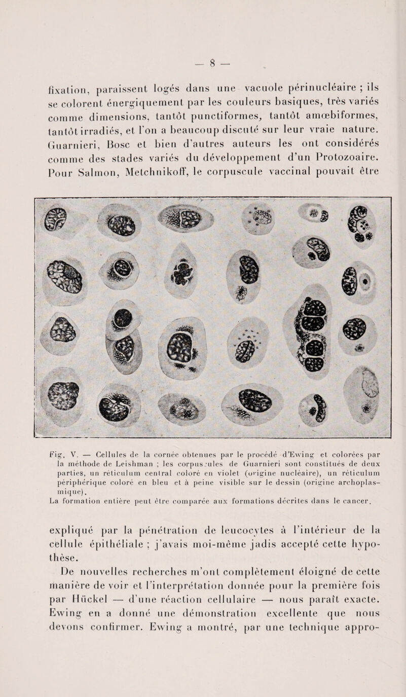 fixation, paraissent logés dans une vacuole périnucléaire ; ils se colorent énergiquement par les couleurs basiques, très variés comme dimensions, tantôt punctiformes, tantôt amœbiformes, tantôt irradiés, et l'on a beaucoup discuté sur leur vraie nature. Guarnieri, Bosc et bien d'autres auteurs les ont considérés comme des stades variés du développement d’un Protozoaire. Pour Salmon, Metchnikoff, le corpuscule vaccinal pouvait être Fig. V. — Cellules de la cornée obtenues par le procédé d’Ewing et colorées par la méthode de Leishman ; les corpus Jules de Guarnieri sont constitués de deux parties, un réticulum central coloré en violet (origine nucléaire), un réticulum périphérique coloré en bleu et à peine visible sur le dessin (origine archoplas- mique). La formation entière peut être comparée aux formations décrites dans le cancer. expliqué par la pénétration de leucocytes à l’intérieur de la cellule épithéliale ; j’avais moi-même jadis accepté cette hypo¬ thèse. De nouvelles recherches m’ont complètement éloigné de cette manière devoir et l’interprétation donnée pour la première fois par Hiickel — d’une réaction cellulaire — nous paraît exacte. Ewing en a donné une démonstration excellente que nous devons confirmer. Ewing a montré, par une technique appro-