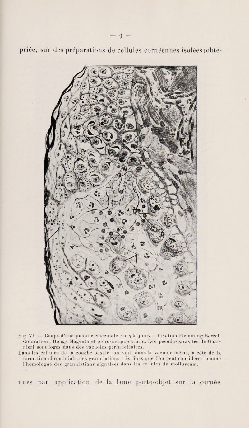 priée, sur des préparations de cellules cornéennes isolées (obte- Fig VI. — Coupe d’une pustule vaccinale au 4-5® jour. — Fixation Flemming-Borrel. Coloration : Rouge Magenta et picro-indigo-carmin. Les pseudo-parasites de Guar- nieri sont logés dans des vacuoles péri nucléaires. Dans les cellules de la couche basale, on voit, dans la vacuole même, à côté de la formation chromidiale, de,s granulations très fines que Ton peut considérer comme l’homologue des granulations signalées dans les cellules du molluscum. nues par application de la lame porte-objet sur la cornée