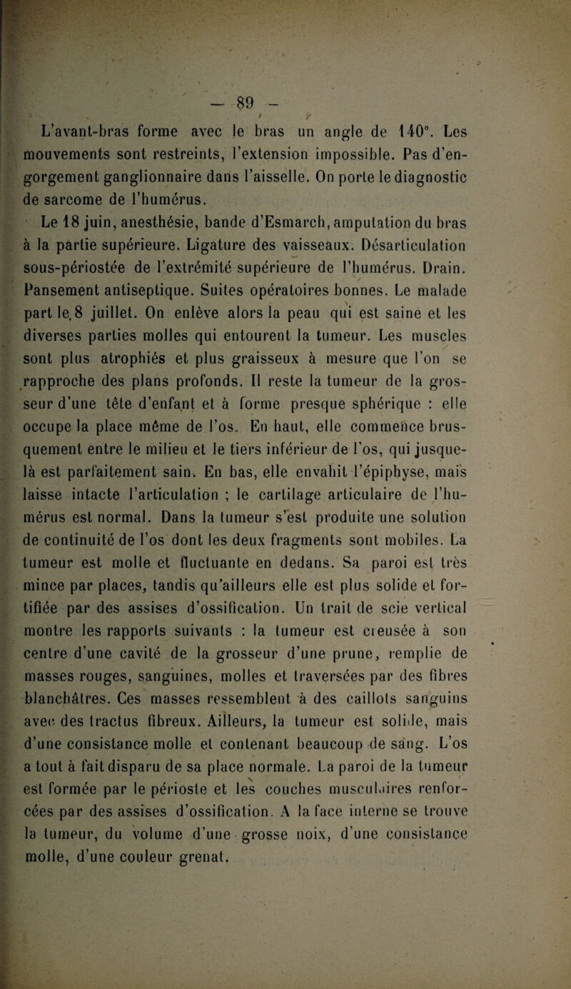 k • -, . * * L’avant-bras forme avec le bras un angle de 140°. Les mouvements sont restreints, l’extension impossible. Pas d’en¬ gorgement ganglionnaire dans l’aisselle. On porte le diagnostic de sarcome de l’humérus. Le 18 juin, anesthésie, bande d’Esmarch, amputation du bras à la partie supérieure. Ligature des vaisseaux. Désarticulation sous-périostée de l’extrémité supérieure de l’humérus. Drain. Pansement antiseptique. Suites opératoires bonnes. Le malade partie, 8 juillet. On enlève alors la peau qui est saine et les diverses parties molles qui entourent la tumeur. Les muscles sont plus atrophiés et plus graisseux à mesure que l’on se rapproche des plans profonds. Il reste la tumeur de la gros¬ seur d’une tête d’enfant et à forme presque sphérique : elle occupe la place même de l’osu En haut, elle commence brus¬ quement entre le milieu et le tiers inférieur de l’os, qui jusque- là est parfaitement sain. En bas, elle envahit l’épiphyse, mais laisse intacte l’articulation ; le cartilage articulaire de l’hu¬ mérus est normal. Dans la tumeur s’est produite une solution de continuité de l’os dont les deux fragments sont mobiles. La tumeur est molle et fluctuante en dedans. Sa paroi est très mince par places, tandis qu’ailleurs elle est plus solide et for- , _ • » tifiée par des assises d’ossification. Un trait de scie vertical montre les rapports suivants : la tumeur est creusée à son centre d’une cavité de la grosseur d’une prune, remplie de masses rouges, sanguines, molles et traversées par des fibres blanchâtres. Ces masses ressemblent à des caillots sanguins avec- des tractus fibreux. Ailleurs, la tumeur est solifie, mais d’une consistance molle et contenant beaucoup de sang. L’os a tout à fait disparu de sa place normale. La paroi de la tumeur est formée par le périoste et les couches musculaires renfor¬ cées par des assises d’ossification. A la face interne se trouve la tumeur, du volume d’une grosse noix, d’une consistance molle, d’une couleur grenat.