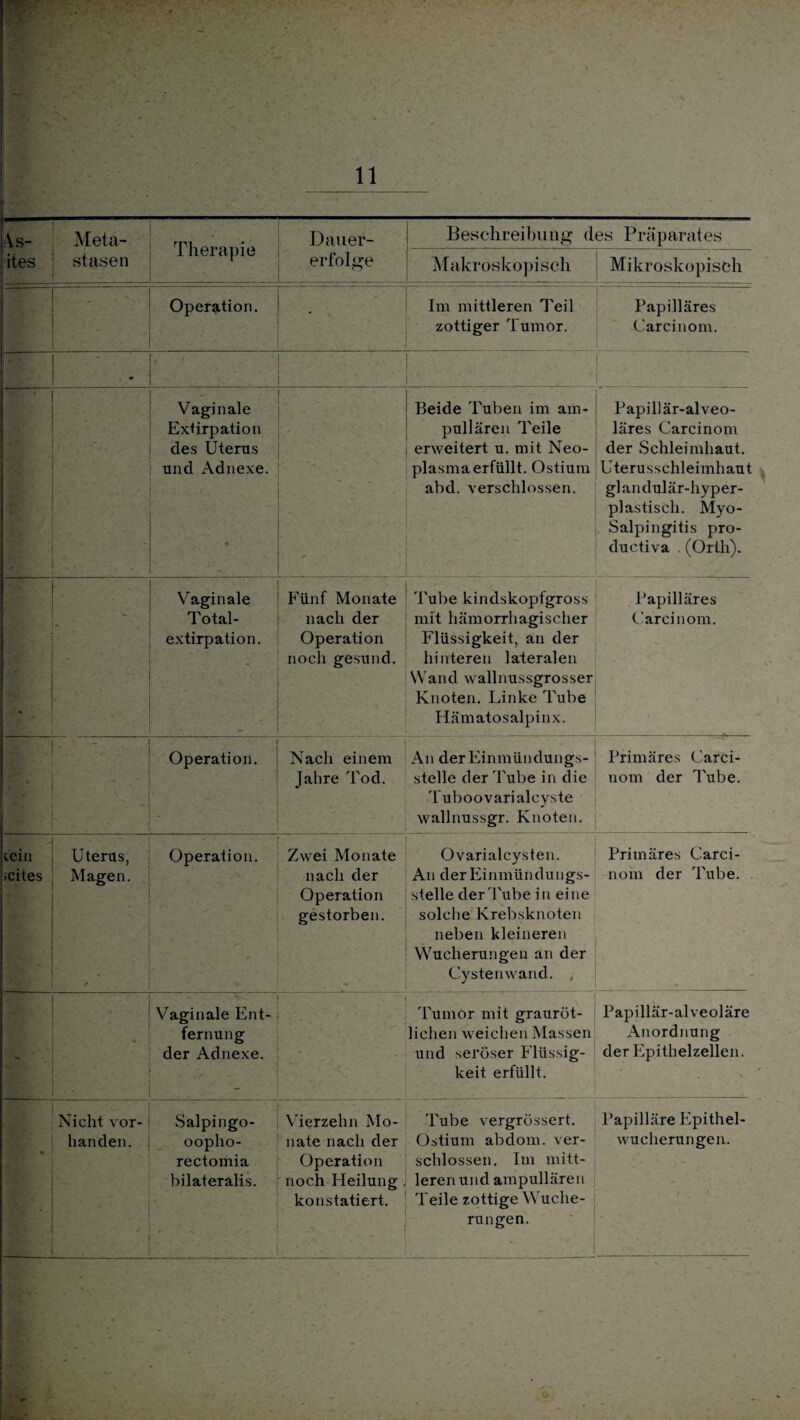 As- ites Meta¬ stasen Therapie Dauer¬ erfolge Beschreibung des Präparates Makroskopisch Mikroskopisch * Operation. * Im mittleren Teil zottiger Tumor. Papilläres Carcinom. ■ I IH Vaginale Extirpation des Uterus und Adnexe. - Beide Tuben im am¬ pullären Teile erweitert u. mit Neo¬ plasmaerfüllt. Ostium abd. verschlossen. Papillär-alveo¬ läres Carcinom der Schleimhaut. Uterusschleimhaut glandulär-hyper¬ plastisch. Myo- Salpingitis pro- ductiva . (Orth). “ - Vaginale Total- extirpation. Fünf Monate nach der Operation noch gesund. Tube kindskopfgross mit hämorrhagischer Flüssigkeit, an der hinteren lateralen Wand wallnussgrosser Knoten. Linke Tube Hämatosalpinx. Papilläres Carcinom. • Operation. Nach einem Jahre Tod. An der Einmündungs¬ stelle der Tube in die Tuboovari alcyste wallnussgr. Knoten. Primäres Carci- nom der Tube. - lein icites * - Uterus, Magen. / Operation. • ' ■ Zwei Monate nach der Operation gestorben. - Ovarialcysten. An der Einmündungs¬ stelle der'Tube in eine solche Krebsknoten neben kleineren Wucherungen an der Cystenwand. , Primäres Carci¬ nom der Tube. 'JC * Vaginale Ent¬ fernung der Adnexe. ' Tumor mit grauröt- lichen weichen Massen und seröser Flüssig¬ keit erfüllt. „ , - . Papillär-alveoläre Anordnung der Epithelzellen. * Nicht vor¬ handen. V Salpingo- oopho- rectomia bilateralis. . Vierzehn Mo¬ nate nach der Operation noch Heilung konstatiert. Tube vergrössert. Ostium abdom. ver¬ schlossen. Im mitt¬ leren und ampullären Teile zottige Wuche¬ rungen. Papilläre Epithel¬ wucherungen.