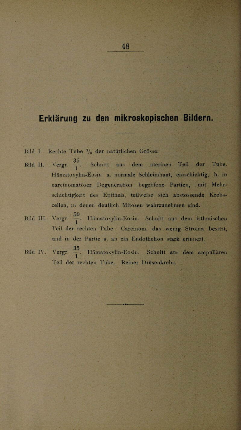 Erklärung zu den mikroskopischen Bildern. Bild I. Bild II. Bild III. Schnitt aus dem uterinen Teil der Tube. Bild IV. Vergr Rechte Tube '2/;J der natürlichen Grösse. v 35 \ergr. Hämatoxylin-Eosin a. normale Schleimhaut, einschichtig, b. in carcinomatöser Degeneration begriffene Partien, mit Mehr¬ schichtigkeit des Epithels, teilweise sich abstossende Krebs¬ zellen, in denen deutlich Mitosen wahrzunehmen sind. 50 \ ergr. —. Ilämatoxylin-Eosin. Schnitt aus dem isthmischen Teil der rechten Tube.' Carcinom, das wenig Stroma besitzt, und in der Partie a. an ein Endothelion stark erinnert. 35 1 Hämatoxylin-Eosin. Schnitt aus dem ampullären Teil der rechten Tube. Reiner Drüsenkrebs.