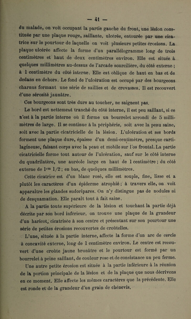 du malade, ou voit occupant la partiê gauche du front, une lésion cons¬ tituée par une plaque rouge, saillante, ulcérée, entourée par une cica¬ trice sur le pourtour de laquelle on voit plusieurs petites érosions. La plaque ulcérée affecte la forme d’un parallélogramme long de trois centimètres et haut de deux centimètres environ. Elle est située à quelques millimètres au-dessus de l’arcade sourcilière, du côté externe ; à 1 centimètre du côté interne. Elle est oblique de haut en bas et de dedans en dehors. Le fond de Fulcération est occupé par des bourgeons charnus formant une série de saillies et de crevasses. Il est recouvert d'une sérosité jaunâtre. Ces bourgeons sont très durs au toucher, ne saignent pas. Le bord est nettement tranché du côté interne, il est peu saillant, si ce n’est à la partie interne où il forme un bourrelet arrondi de 5 milli¬ mètres de large. Il se continue à la périphérie, soit avec la peau saine, soit avec la partie cicatricielle de la lésion. L'ulcération et ses bords forment une plaque dure, épaisse d’un demi-centimètre, presque carti¬ lagineuse, faisant corps avec la peau et mobile sur Los frontal. La partie cicatricielle forme tout autour de l’ulcération, sauf sur le côté interne du quadrilatère, une auréole large en haut de 1 centimètre ; du côté externe de lcm 1/2; en bas, de quelques millimètres. Cette cicatrice est d’un blanc rosé, elle est souple, fine, lisse et a plutôt les caractères d’un épiderme atrophié ; à travers elle, on voit apparaître les glandes sudoripares. On n’y distingue pas de nodules ni de desquamation. Elle paraît tout à fait saine. A la partie toute supérieure de la lésion et touchant la partie déjà décrite par son bord inférieur, on trouve une plaque de la grandeur d'un haricot, cicatrisée à son centre et présentant sur son pourtour une série de petites érosions recouvertes de croùtelles. L'une, située à la partie interne, affecte la forme dun arc de cercle à concavité externe, long de 1 centimètre environ. Le centre est recou¬ vert d’une croûte jaune brunâtre et le pourtour est formé par un bourrelet à peine saillant, de couleur rose et de consistance un peu ferme. Une autre petite érosion est située à la partie inférieure à la réunion de la portion principale de la lésion et de la plaque que nous décrivons en ce moment. Elle affecte les memes caractères que la precedente. Elle est ronde et de la grandeur d’un grain de cbénevis,