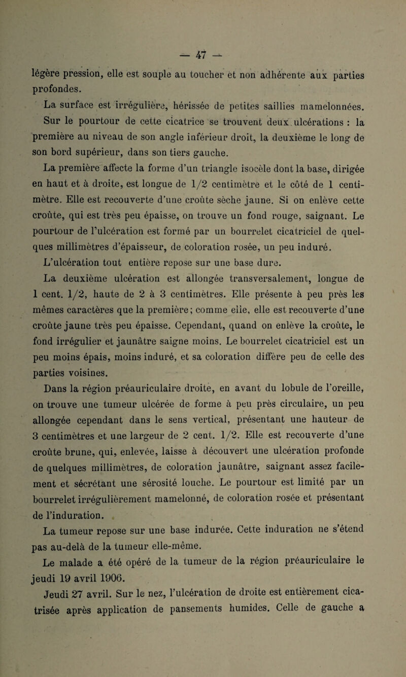 légère pression, elle est souple au toucher et non adhérente aux parties profondes. La surface est irrégulière, hérissée de petites saillies mamelonnées. Sur le pourtour de cette cicatrice se trouvent deux ulcérations : la première au niveau de son angle inférieur droit, la deuxième le long de son bord supérieur, dans son tiers gauche. La première affecte la forme d’un triangle isocèle dont la base, dirigée en haut et à droite, est longue de 1/2 centimètre et le côté de 1 centi¬ mètre. Elle est recouverte d’une croûte sèche jaune. Si on enlève cette croûte, qui est très peu épaisse, on trouve un fond rouge, saignant. Le pourtour de Tulcération est formé par un bourrelet cicatriciel de quel¬ ques millimètres d’épaisseur, de coloration rosée, un peu induré. L’ulcération tout entière repose sur une base dure. La deuxième ulcération est allongée transversalement, longue de 1 cent. 1/2, haute de 2 à 3 centimètres. Elle présente à peu près les mêmes caractères que la première; comme elle, elle est recouverte d’une croûte jaune très peu épaisse. Cependant, quand on enlève la croûte, le fond irrégulier et jaunâtre saigne moins. Le bourrelet cicatriciel est un peu moins épais, moins induré, et sa coloration diffère peu de celle des parties voisines. Dans la région préauriculaire droite, en avant du lobule de l’oreille, on trouve une tumeur ulcérée de forme à peu près circulaire, un peu allongée cependant dans le sens vertical, présentant une hauteur de 3 centimètres et une largeur de 2 cent. 1/2. Elle est recouverte d’une croûte brune, qui, enlevée, laisse à découvert une ulcération profonde de quelques millimètres, de coloration jaunâtre, saignant assez facile¬ ment et sécrétant une sérosité louche. Le pourtour est limité par un bourrelet irrégulièrement mamelonné, de coloration rosée et présentant de l’induration. La tumeur repose sur une base indurée. Cette induration ne s’étend pas au-delà de la tumeur elle-même. Le malade a été opéré de la tumeur de la région préauriculaire le jeudi 19 avril 1906. Jeudi 27 avril. Sur le nez, l’ulcération de droite est entièrement cica¬ trisée après application de pansements humides. Celle de gauche a