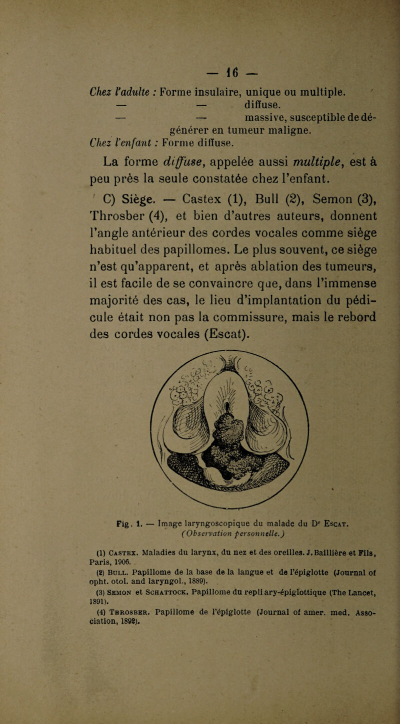 Chez l'adulte : Forme insulaire, unique ou multiple. — — diffuse. — — massive, susceptible de dé¬ générer en tumeur maligne. Chez l’enfant : Forme diffuse. La forme diffuse, appelée aussi multiple, est à peu près la seule constatée chez l’enfant. C) Siège. — Castex (1), Bull (2), Semon (3), Throsber (4), et bien d’autres auteurs, donnent l’angle antérieur des cordes vocales comme siège habituel des papillomes. Le plus souvent, ce siège n’est qu’apparent, et après ablation des tumeurs, il est facile de se convaincre que, dans l’immense majorité des cas, le lieu d’implantation du pédi¬ cule était non pas la commissure, mais le rebord des cordes vocales (Escat). Fig. 1. — I mage laryngoscopique du malade du Dr Escat. (Observation personnelle.) (1) Castex. Maladies du larynx, du nez et des oreilles. J.Baillière et Fils, Paris, 1906. . (2) Bull. Papillome de la base de la langue et de l’épiglotte (Journal of opht. otol. and laryngol., 1889). (3) Semon et Schattock. Papillome du repli ary-épiglottique (The Lancet, 1891). (4) Throsber. Papillome de l’épiglotte (Journal of amer. med. Asso¬ ciation, 1898).